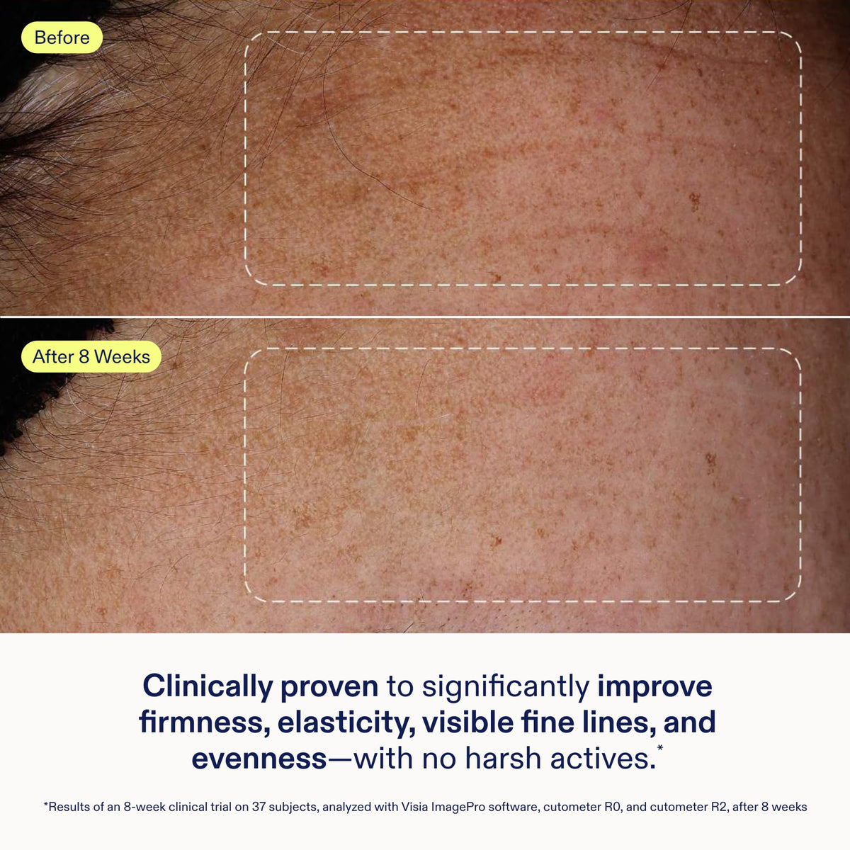 Skinfix Exo Ectoin Intensive Repair Baume - Skinfix Official Imagery - 5