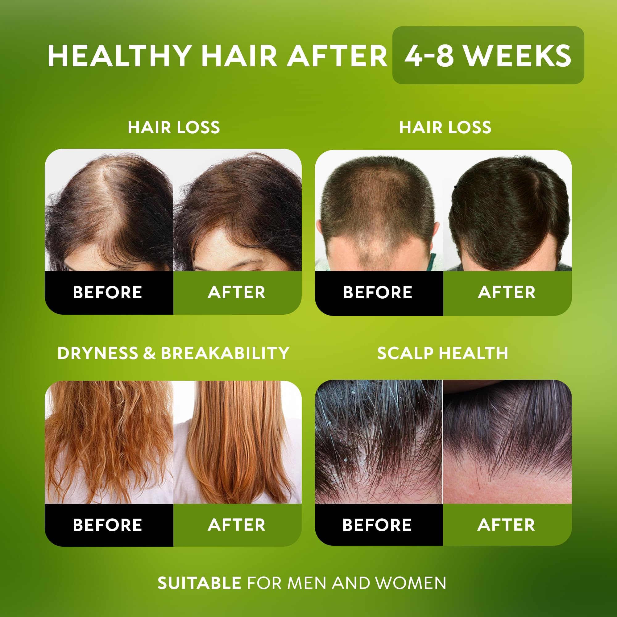 RICHGRAND Batana Oil for Hair Growth - 100% Raw & Organic Unrefined Batana Oi - RICHGRAND Official Product View 3