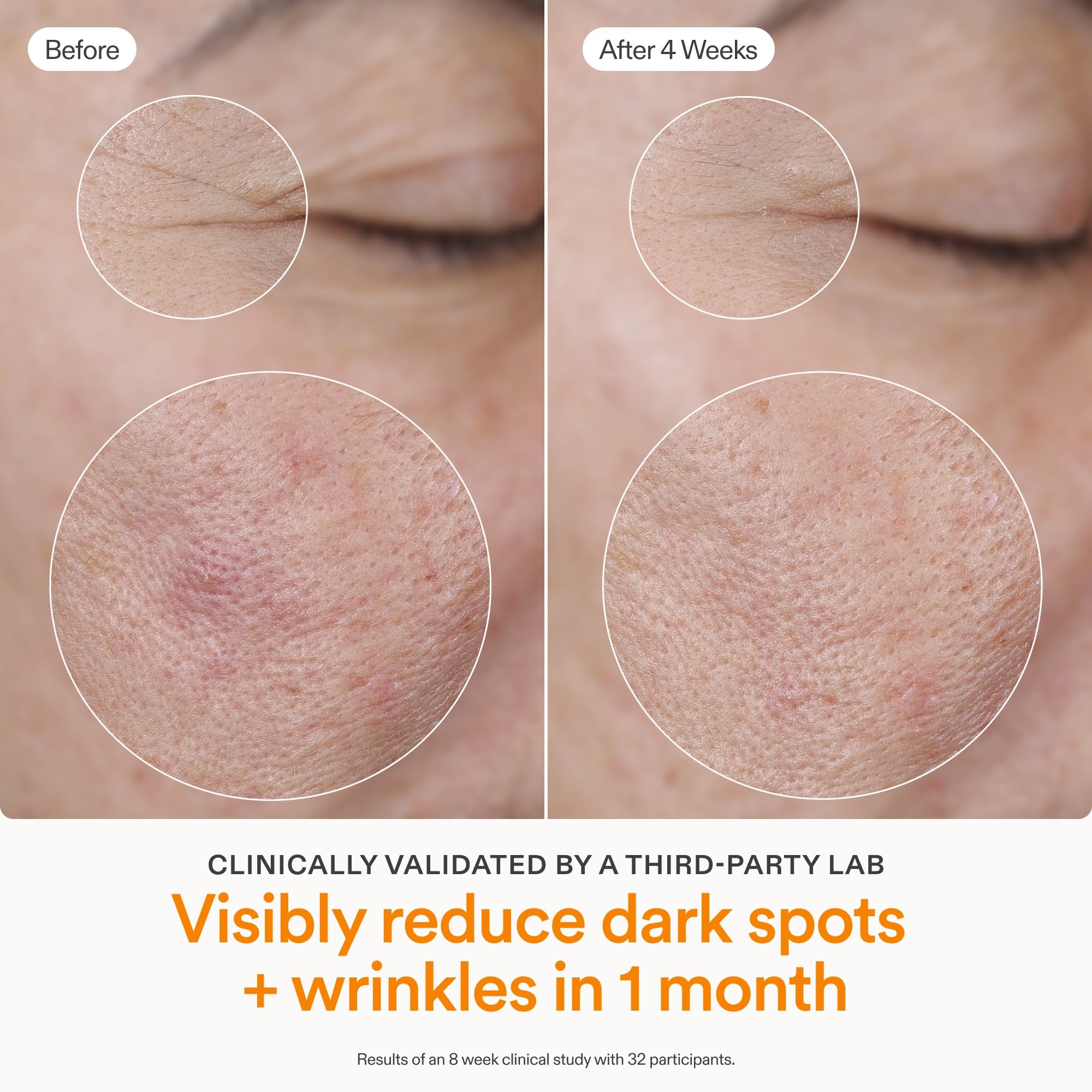 Skinfix Brighten Firm 15 Vitamin C Serum for Face - Skinfix Official Imagery - 6