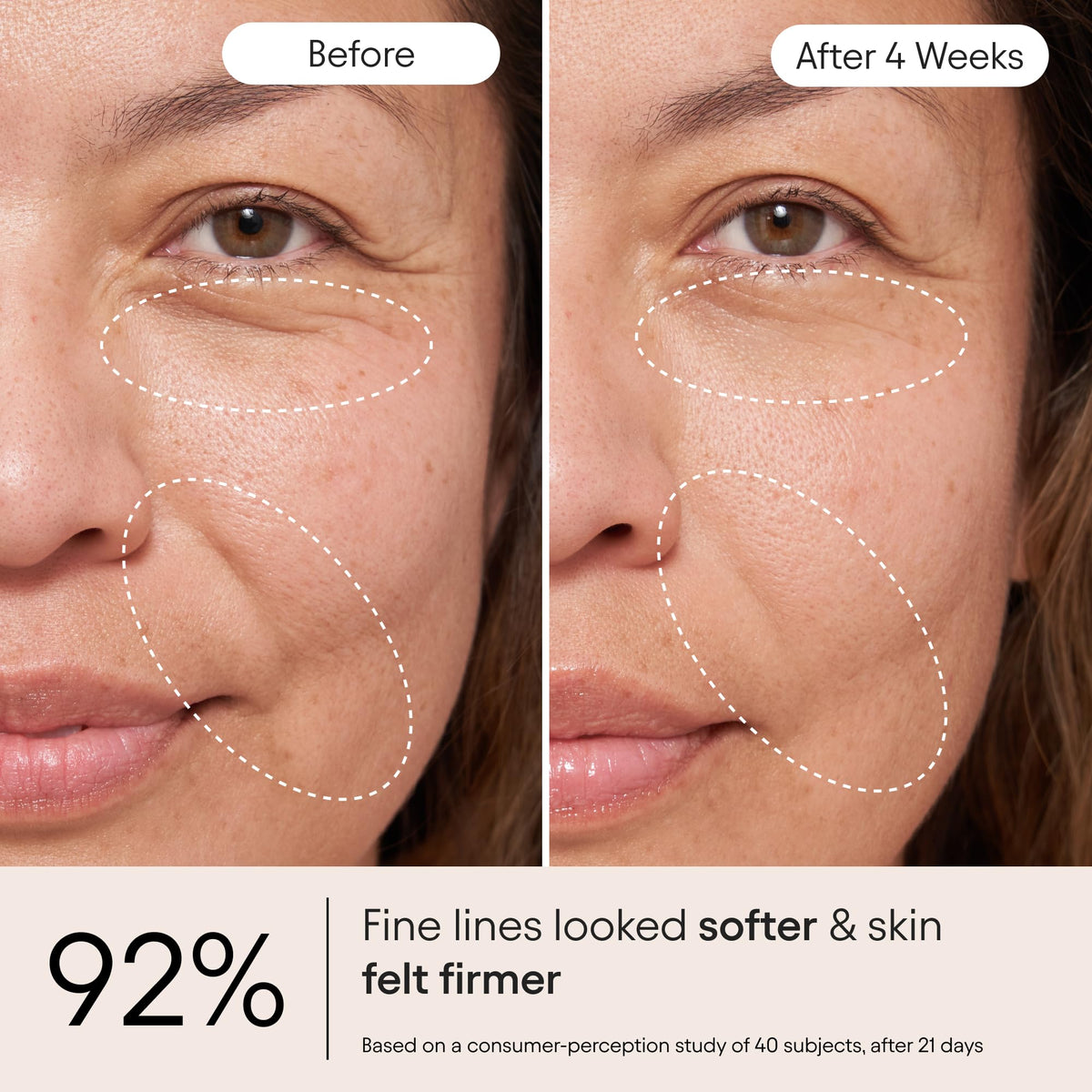 ALPYN Firming Peptide Barrier Repair Cream For Eczema - Alpyn Beauty Official Imagery - 4