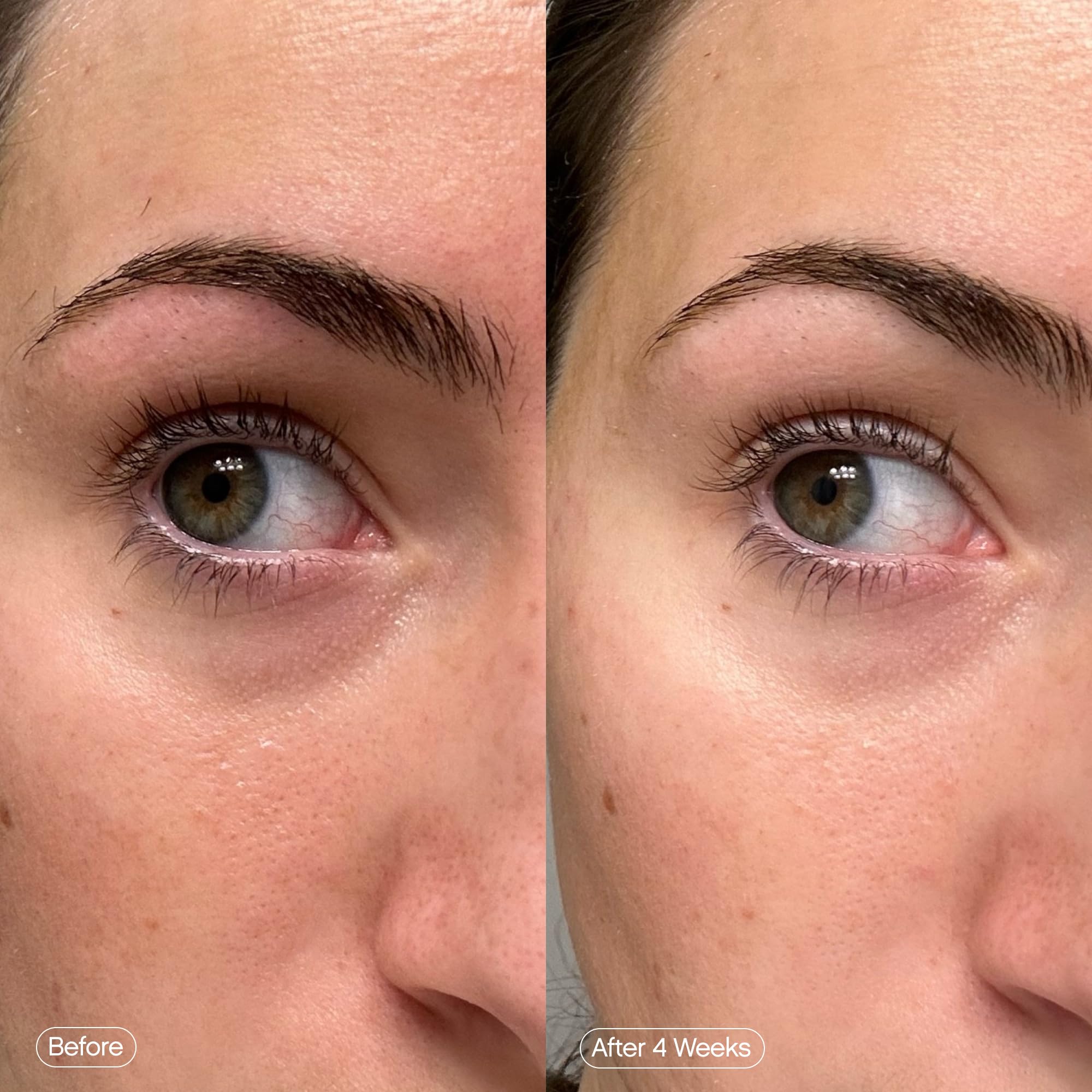 Topicals Faded Brightening Under Eye Masks Depuffs Brightens - Topicals Official Imagery - 6