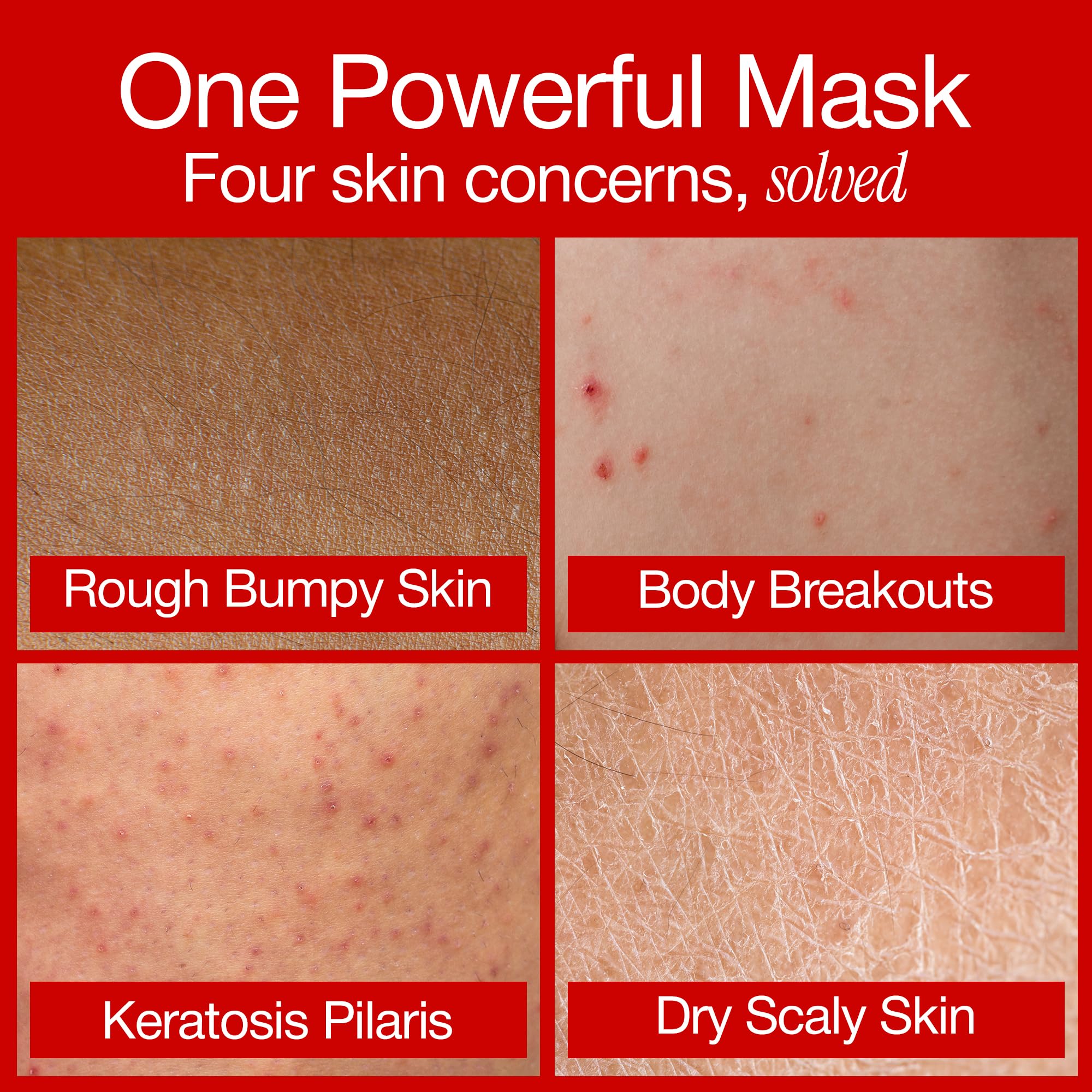 ABI AME Body Exfoliator 30% AHA 2% BHA Pre - Shower Exfoliating Mask - ABI AME Official Product View 4