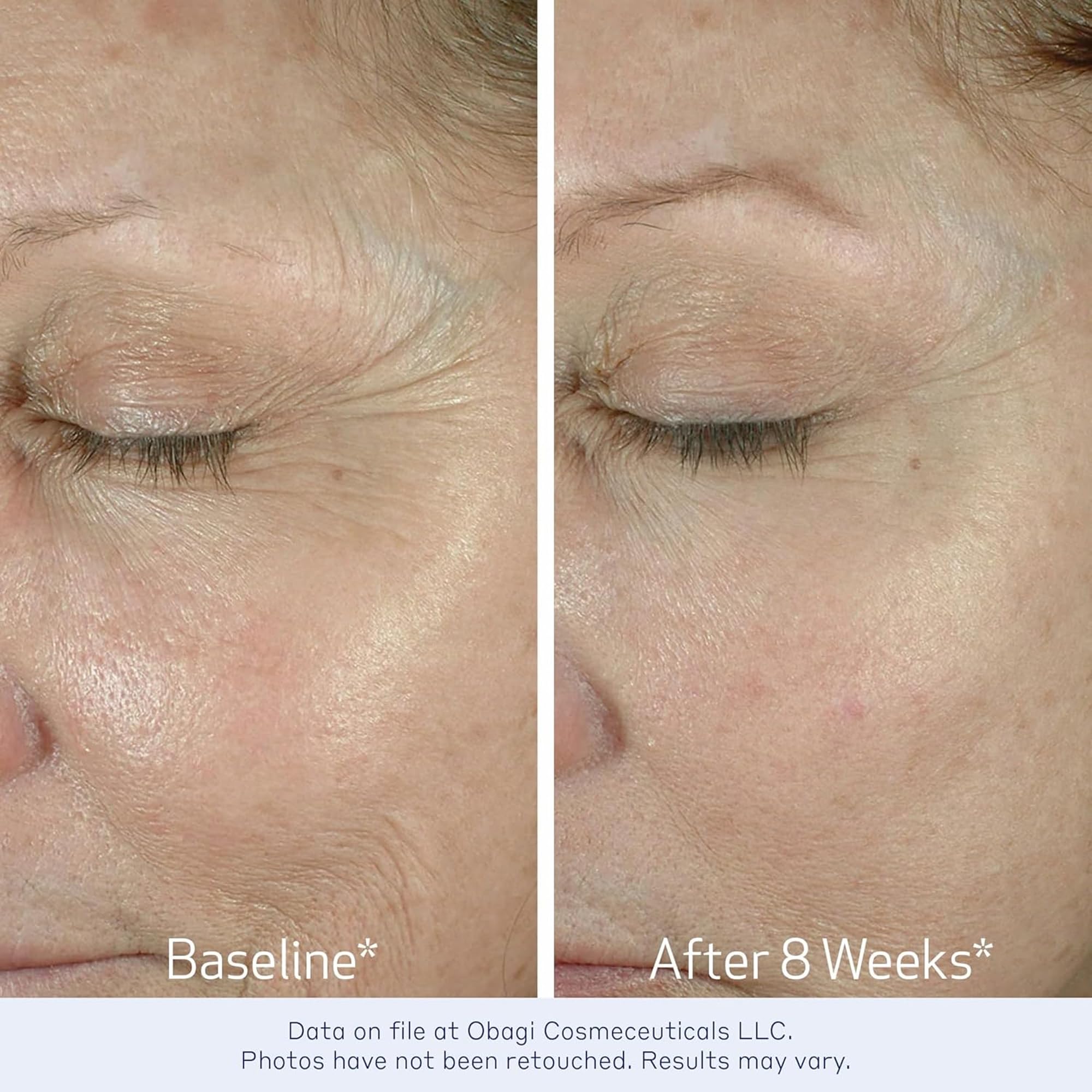 Obagi ELASTIDERM Eye Cream - Elefair Tech Official Product View 5