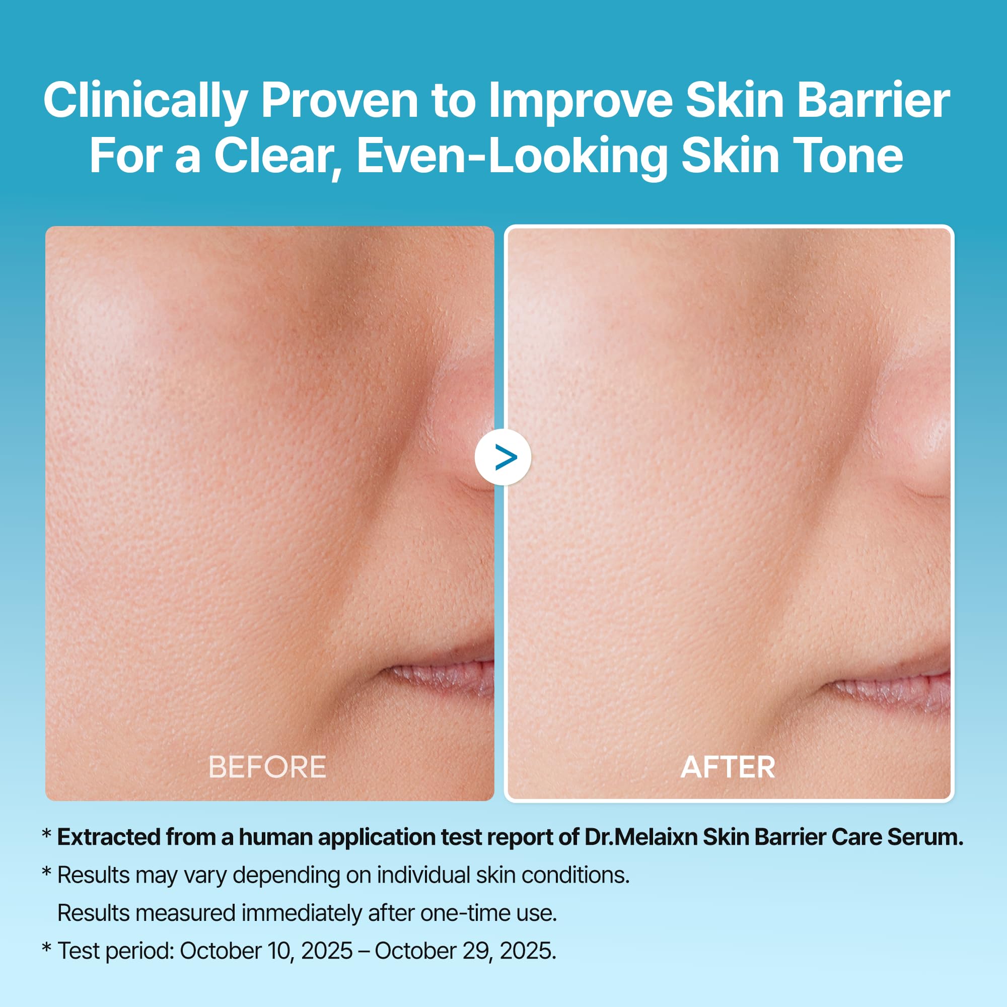 Dr.Melaxin Peel Shot Exfoliating TX Serum 80ml – 99% Pure - Dr.Melaxin