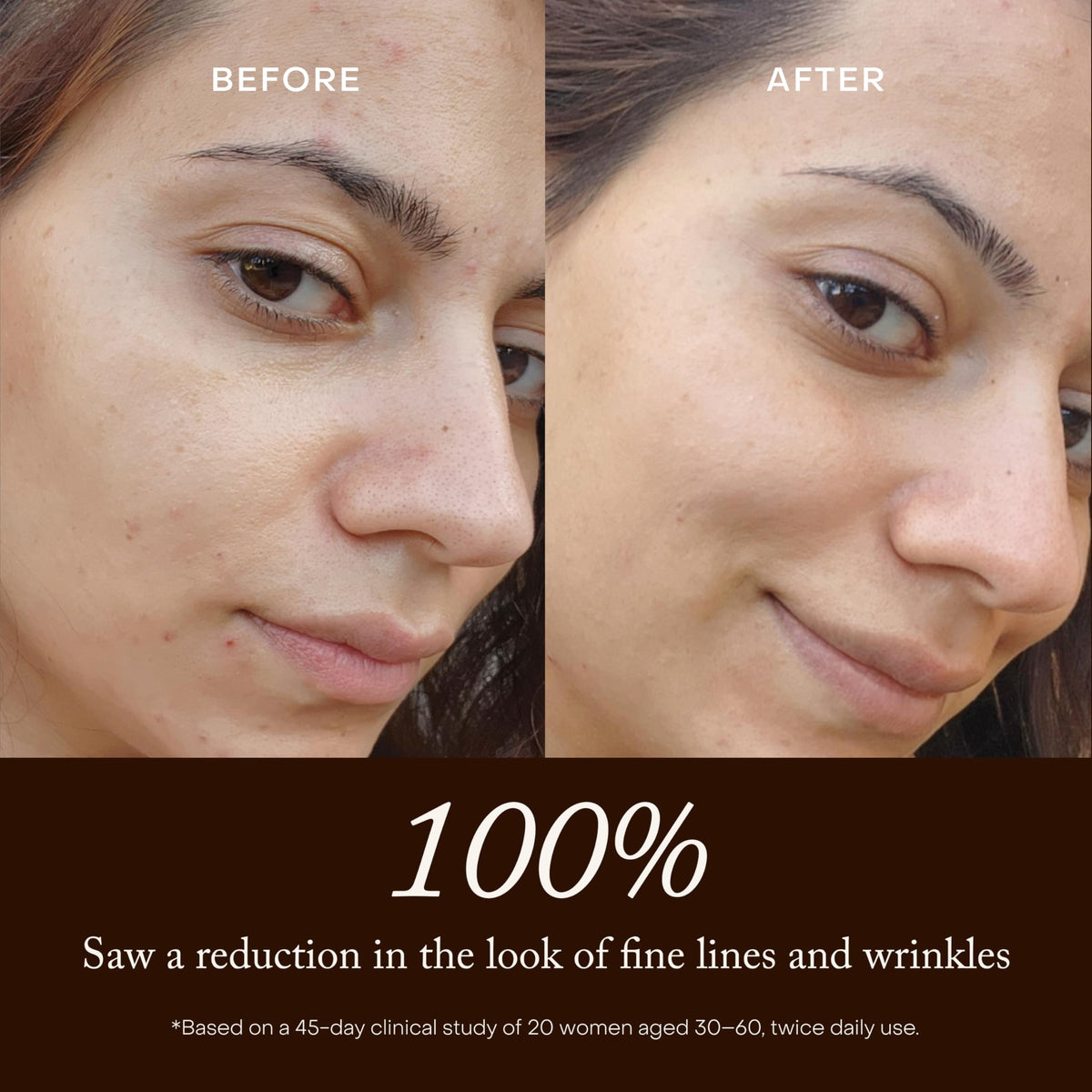 True Botanicals Renew Pure Radiance Face Oil with Rosehip 1 - True Botanicals Official Imagery - 5