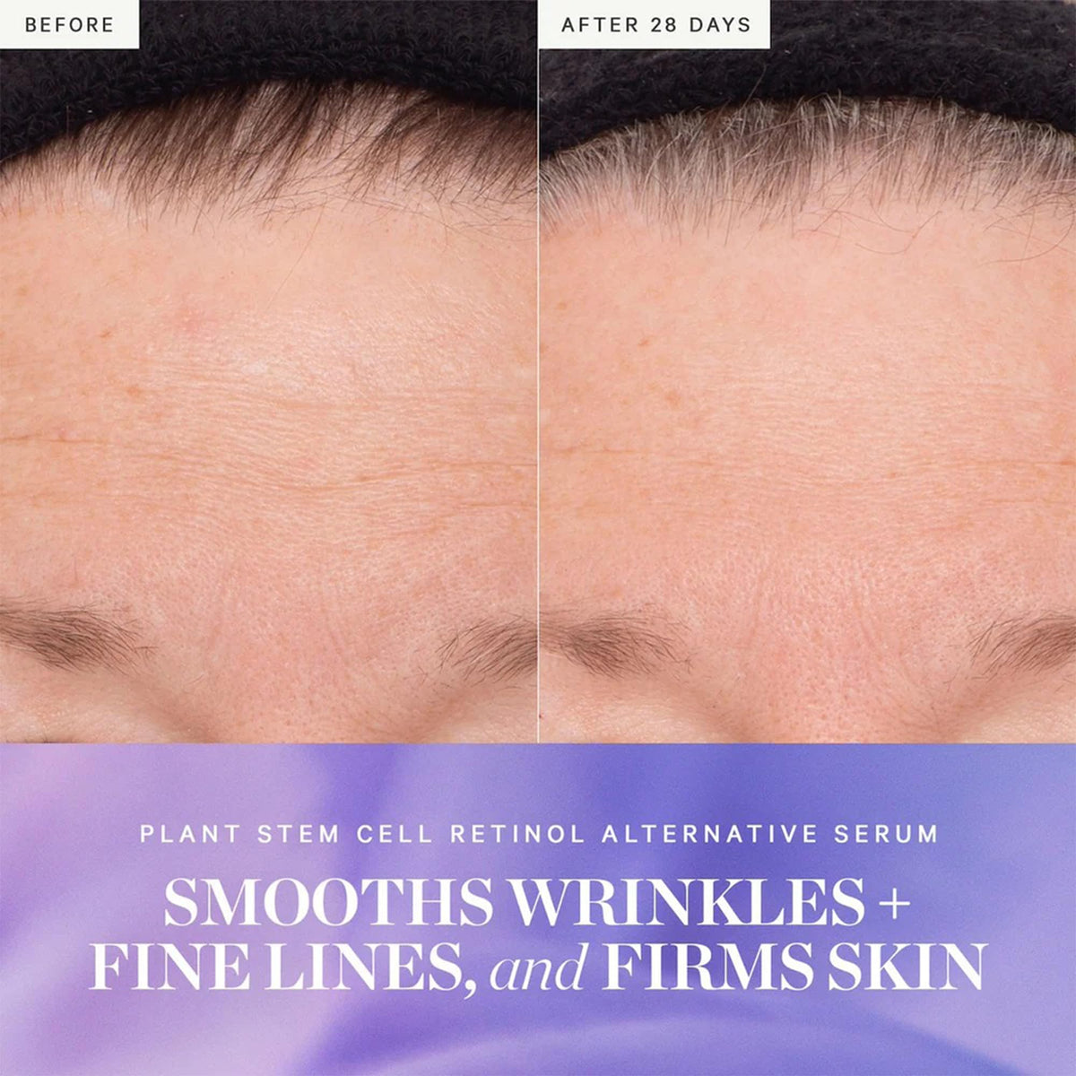 KORA Organics Plant Stem Cell Retinol Alternative Bakuchiol - KORA Organics Official Imagery - 3