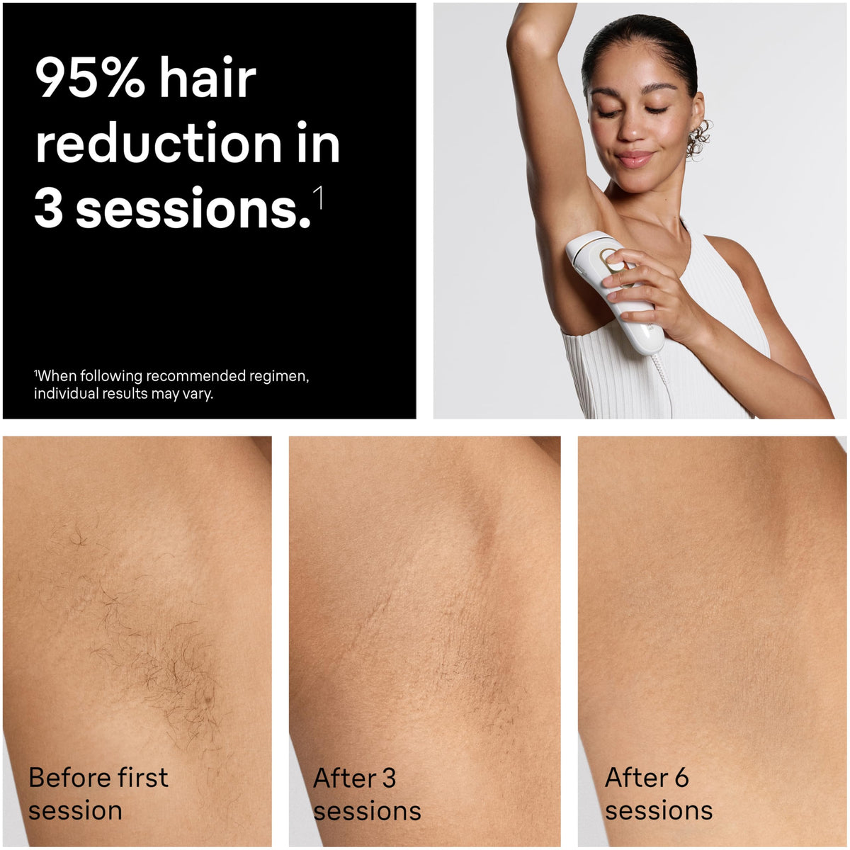 Braun IPL Silk Expert Pro 5 IPL Hair Removal for Women and - Braun Official Imagery - 5
