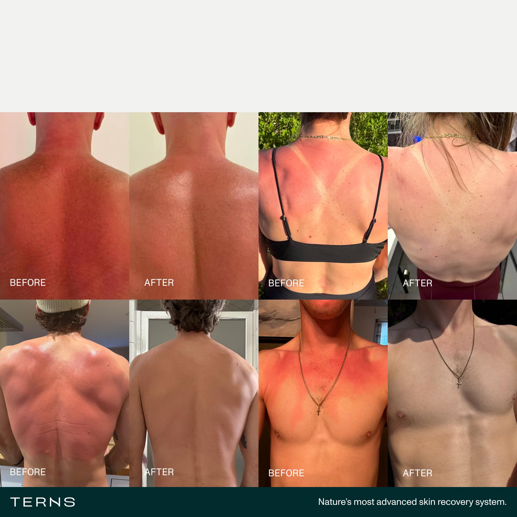 TERNS Mayday after sun lotion in 2 oz bottle, moisturizing skin relief for burn and peeling recovery.