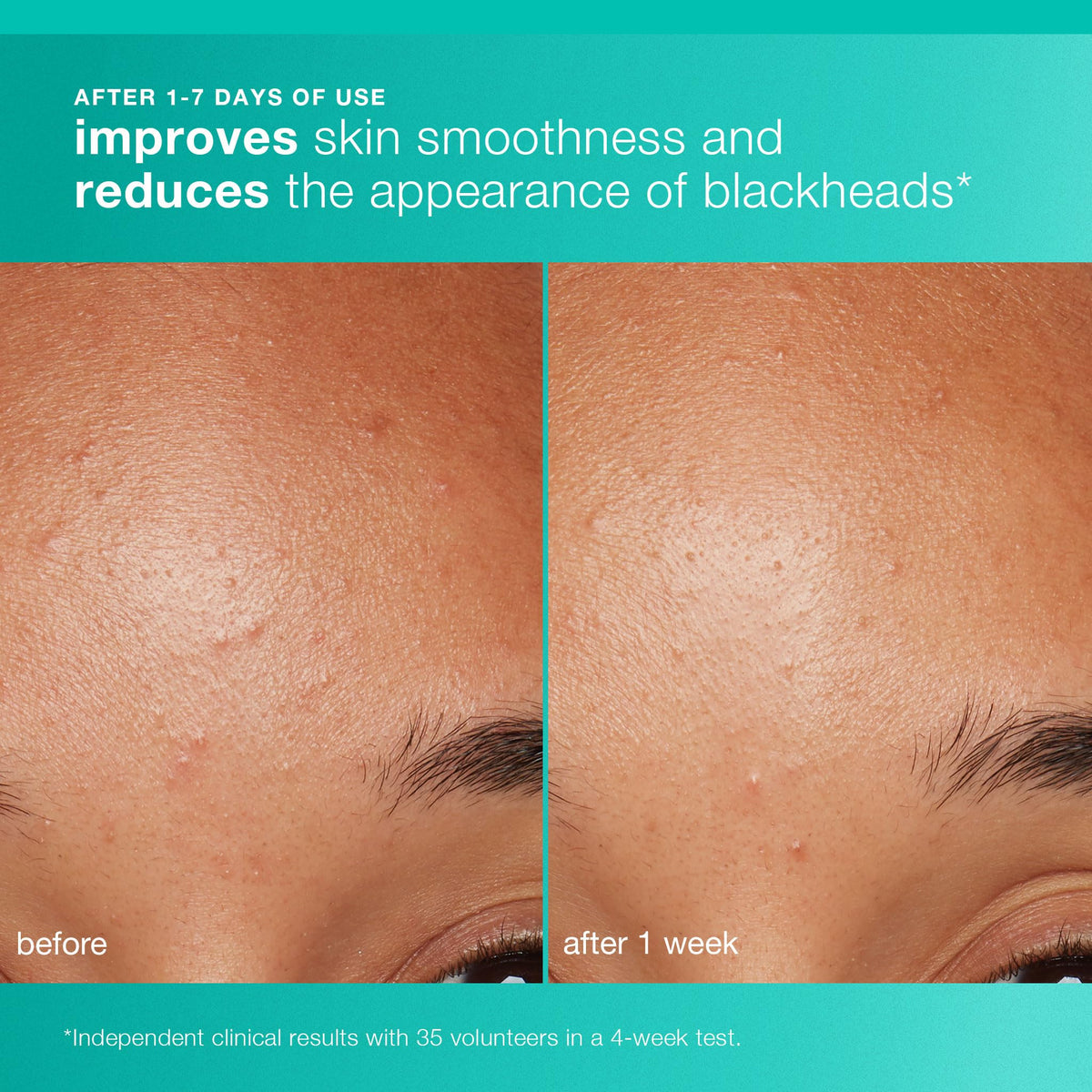 Dermalogica Clear and Brighten Kit Travel Size - Premium Selection Official Imagery - 5