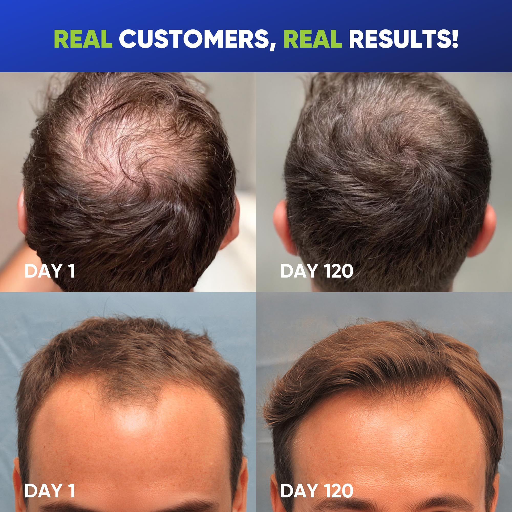 Hair Growth Shampoo for Men - Svvimer Official Imagery - 4