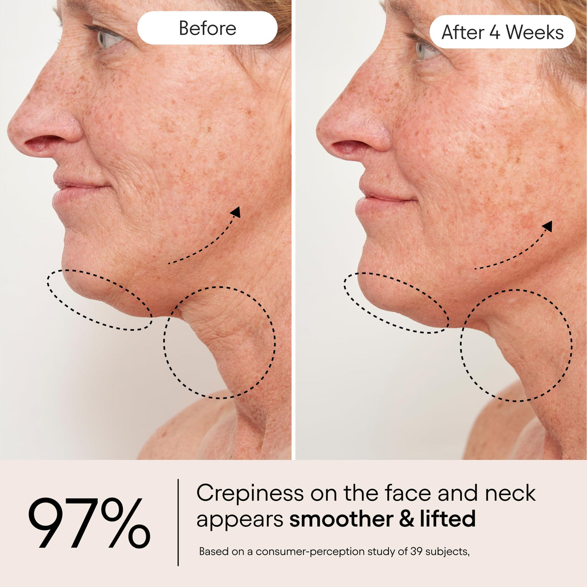 ALPYN Super Sculpt Peptide Firming Lifting Serum for Face - Alpyn Beauty Official Imagery - 6