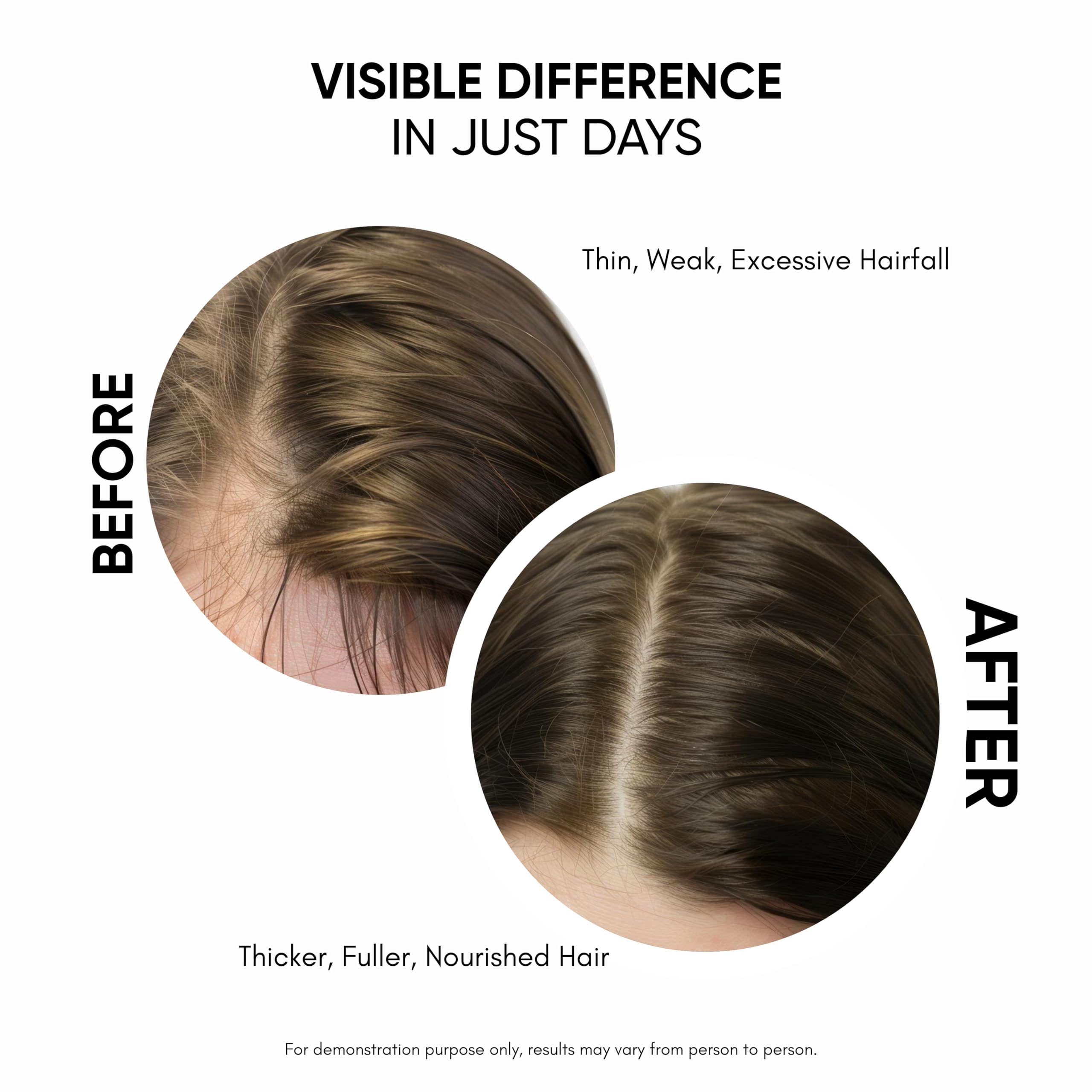 Masofta Hair Growth Serum For Density, Hair fall Control with 3% Redensyl, 5% - Masofta Official Product View 5