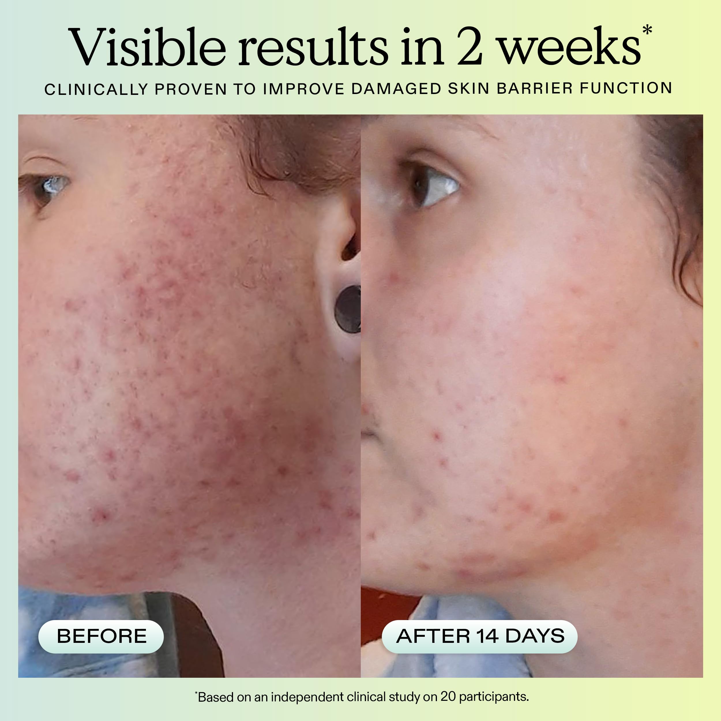 KraveBeauty Great Barrier Relief Face Serum for Dry, Sensitive - KraveBeauty