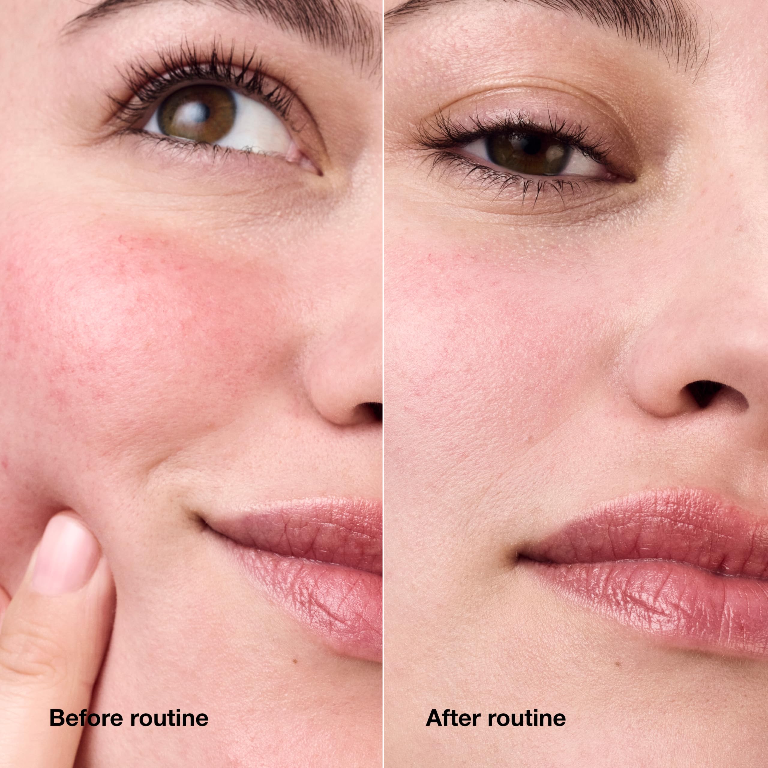 Clinique Redness Solutions Daily Relief Cream with Microbiome - Generic