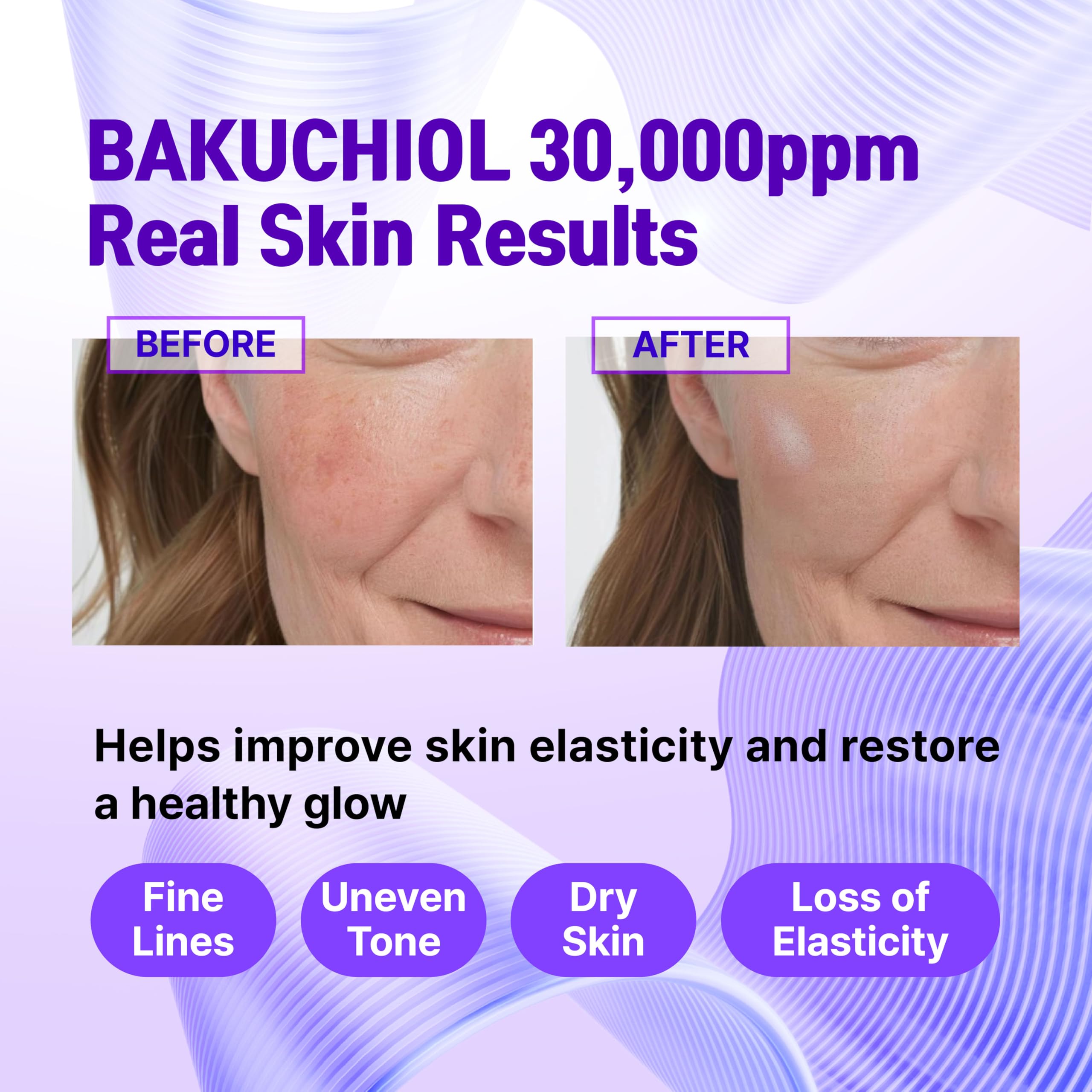 CELDYQUE Korean Bakuchiol Concentrate DIY Mix - in Serum 30 & 000 ppm High - CELDYQUE Official Product View 4