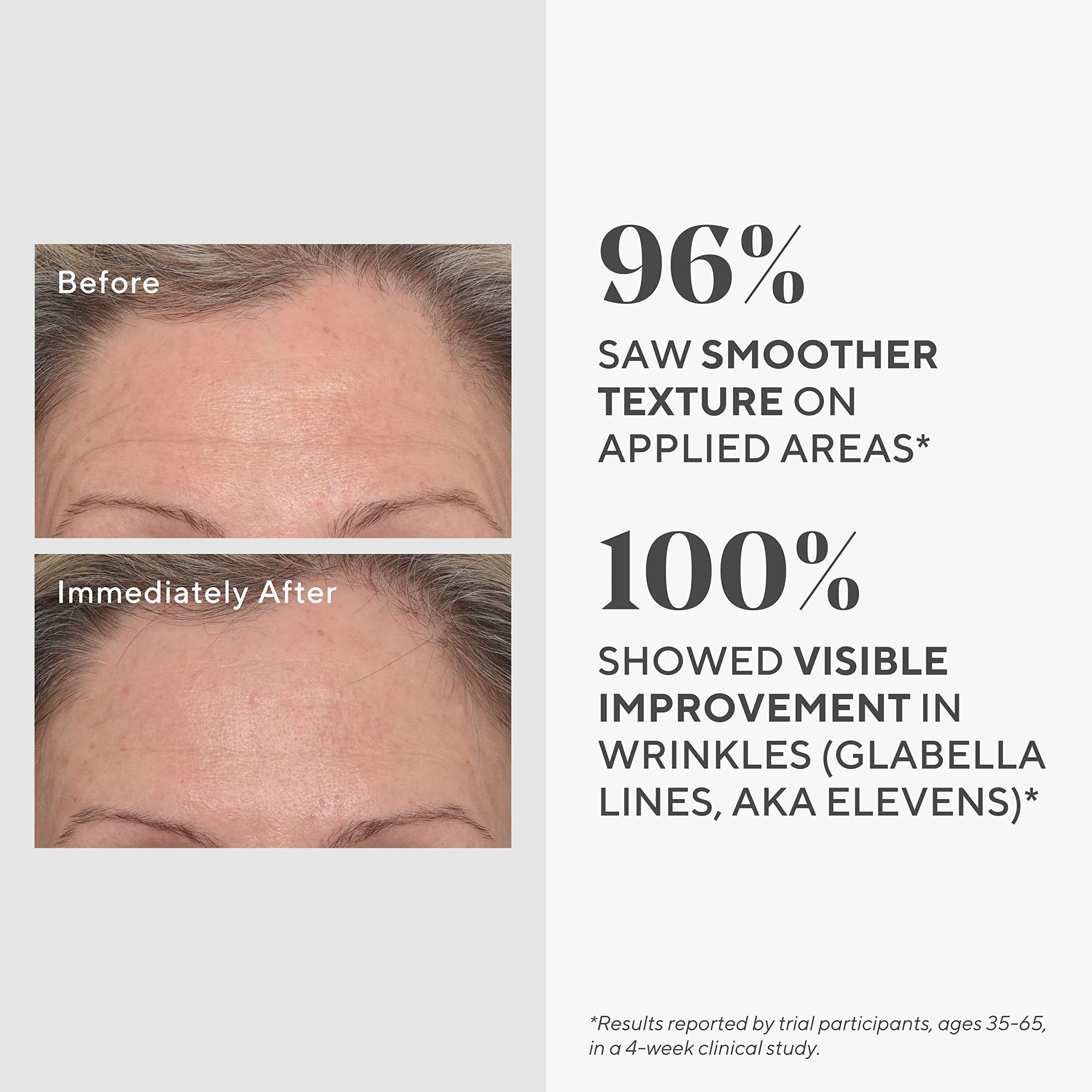 Murad Targeted Wrinkle Corrector - Elefair Store Official Product Imagery - 4