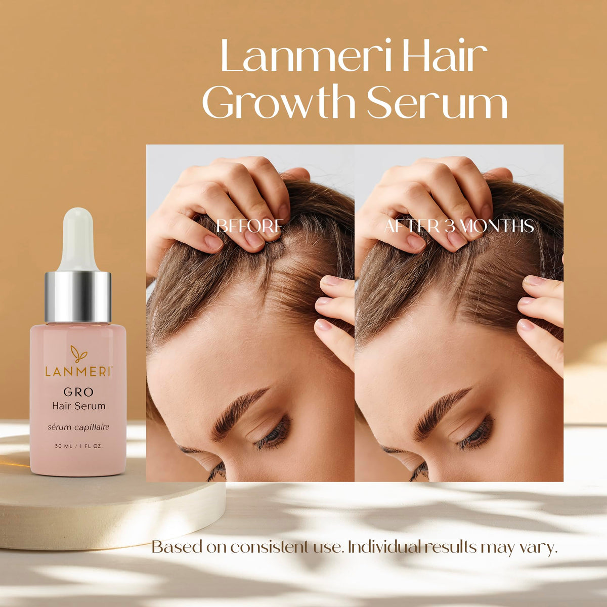 Vegan Hair Growth Serum - Lanmeri Official Imagery - 3