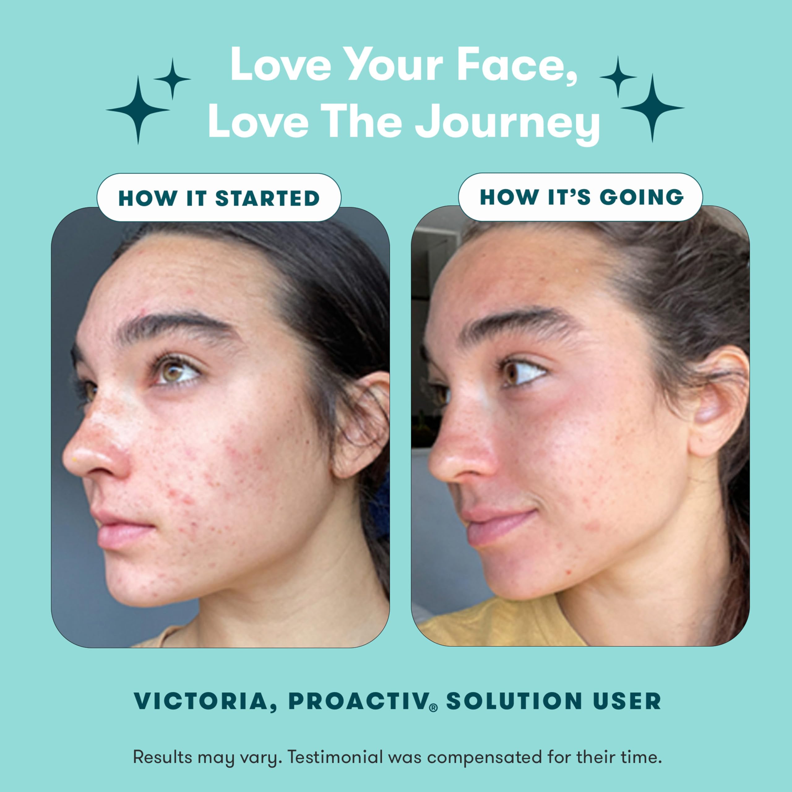 Proactiv 3 Step Acne Treatment - Proactiv