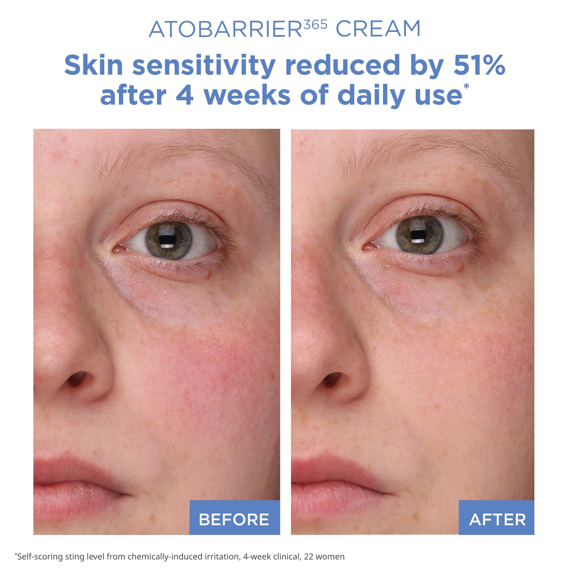 AESTURA ATOBARRIER365 Cream with Ceramides, Korean Face - AESTURA