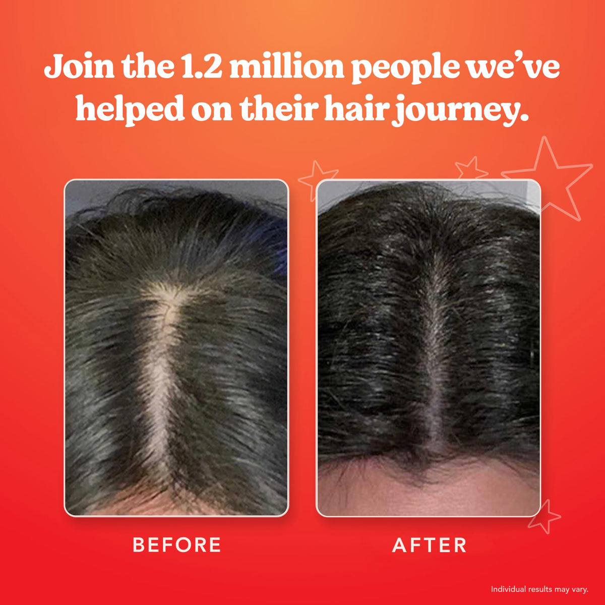 HAIRtamin Scalp Serum for Thicker Looking Hair and Dry Scalp - HAIRtamin Official Imagery - 5