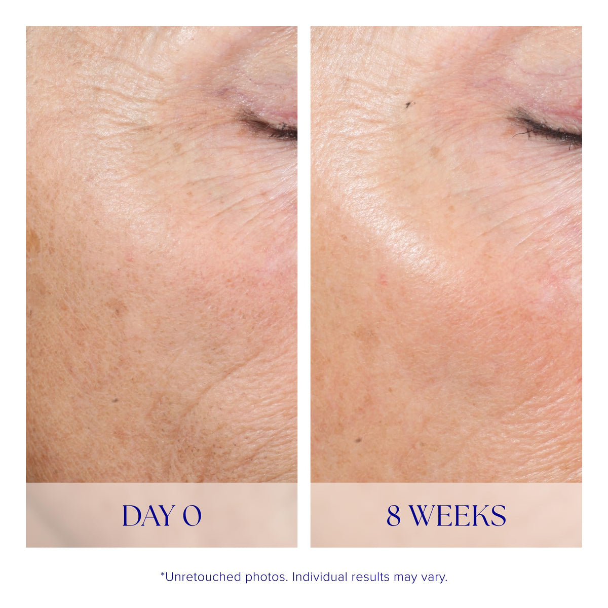 iS CLINICAL Active Peel System two step gentle at home peel - Premium Selection Official Imagery - 5