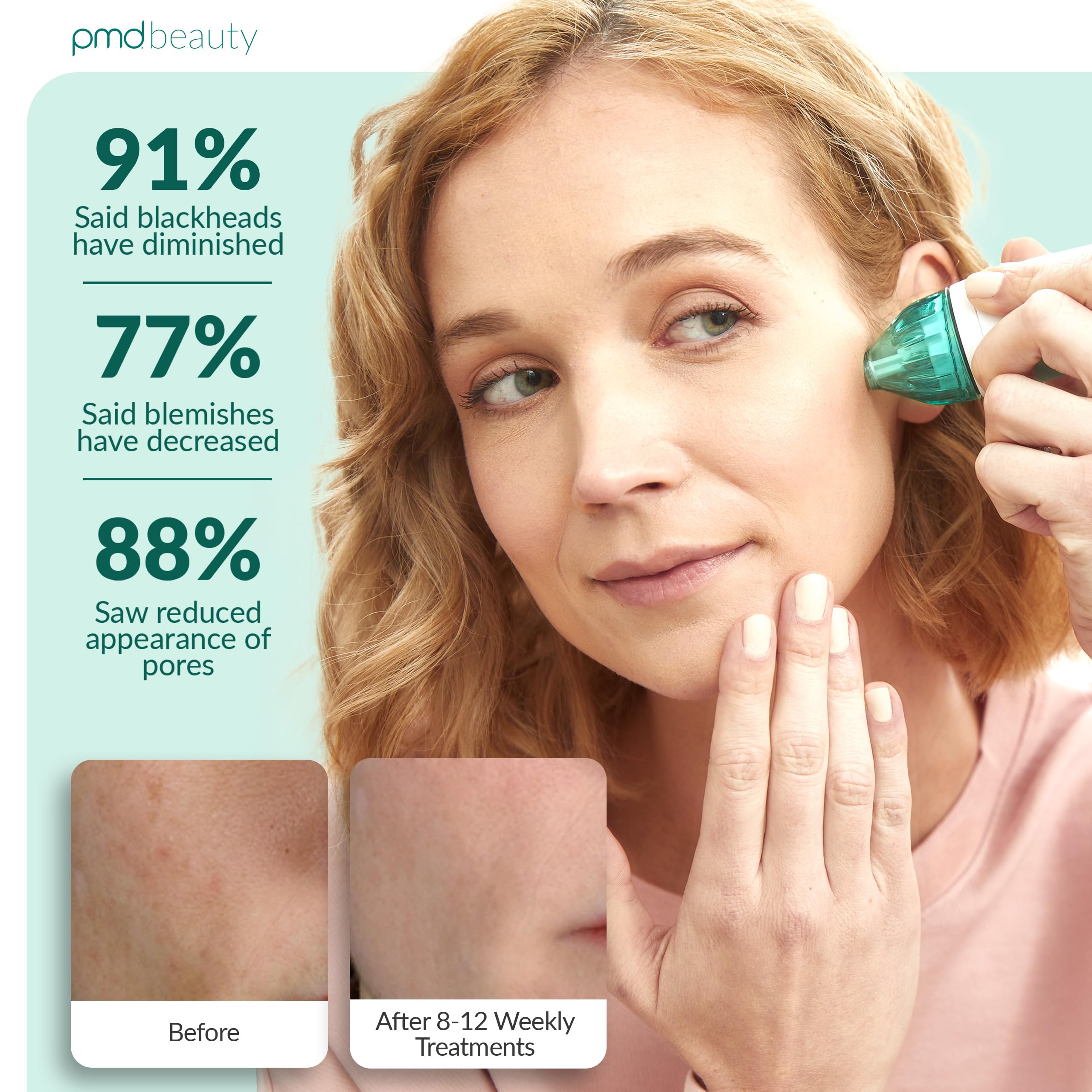 PMD Beauty Personal Microderm Classic - Generic
