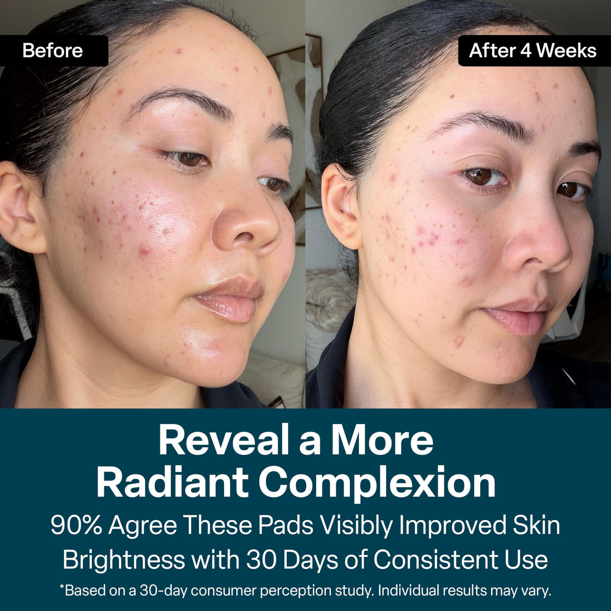 QRxLabs Glycolic Acid Pads - QRxLabs Official Imagery - 7