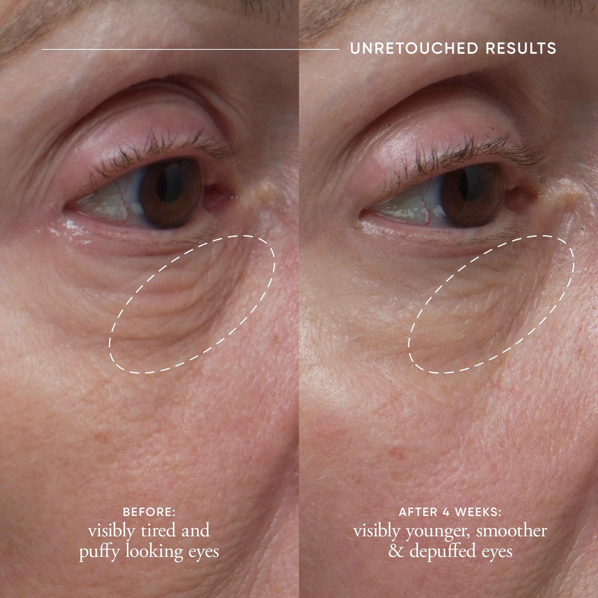 philosophy dose of wisdom bouncy skin reactivating facial serum - Generic