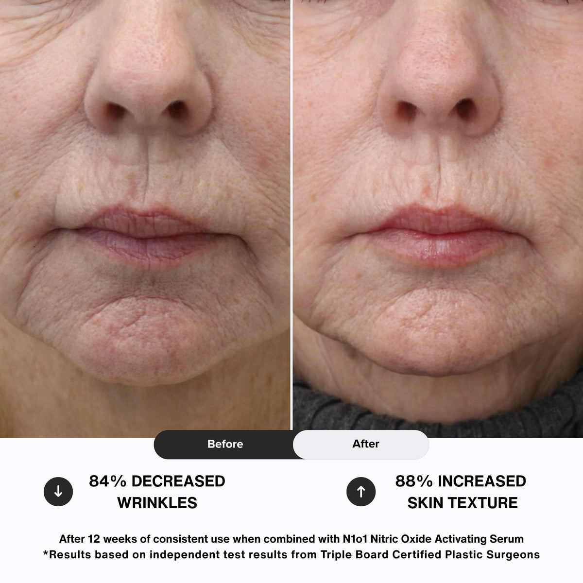 N1O1 Nitric Oxide Face Cream Anti Aging Skincare Routine 1 - N1O1 Official Product Imagery - 6