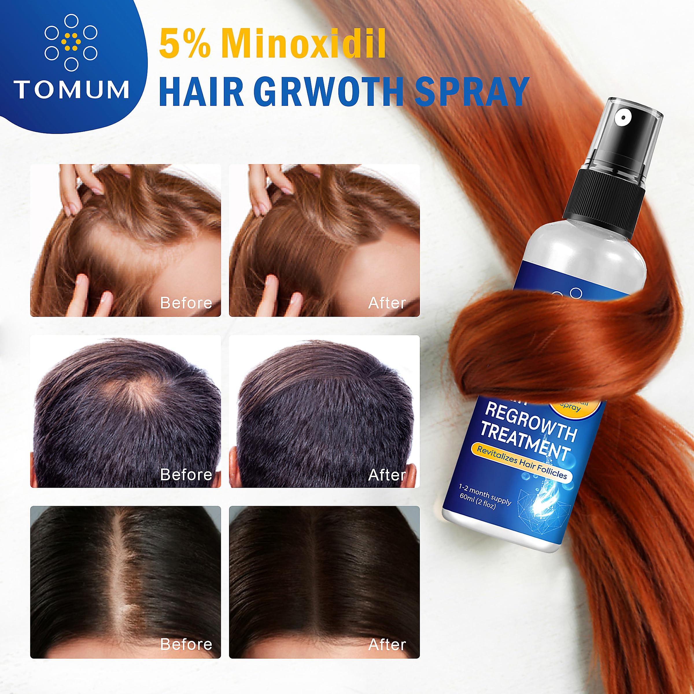 TOMUM 5% Minoxidil Topical Spray for Hair Regrowth 60ml 2-Pack