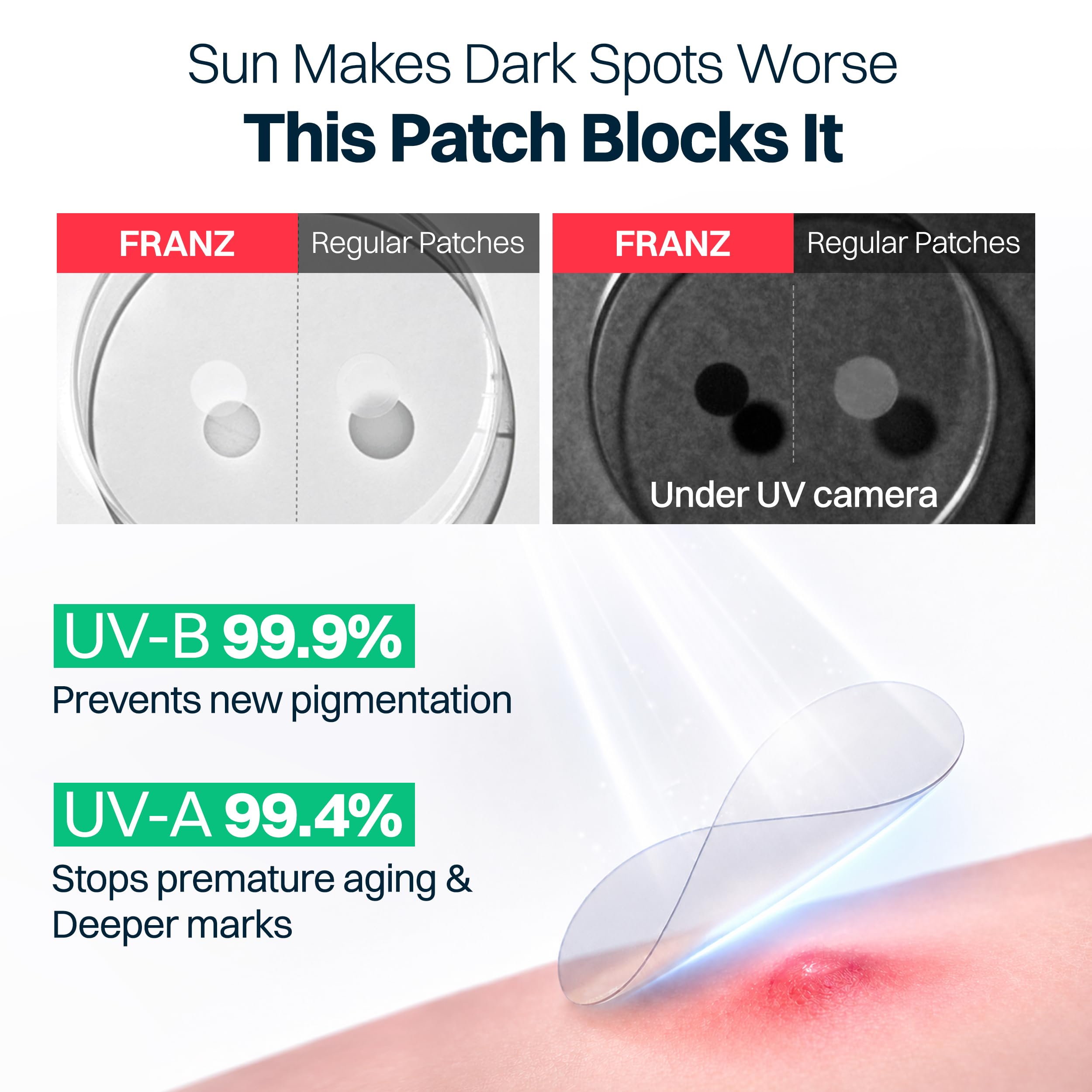 FRANZ Invisible Post Acne Mark Patches Tone Care Dots - FRANZ Official Product Imagery - 7