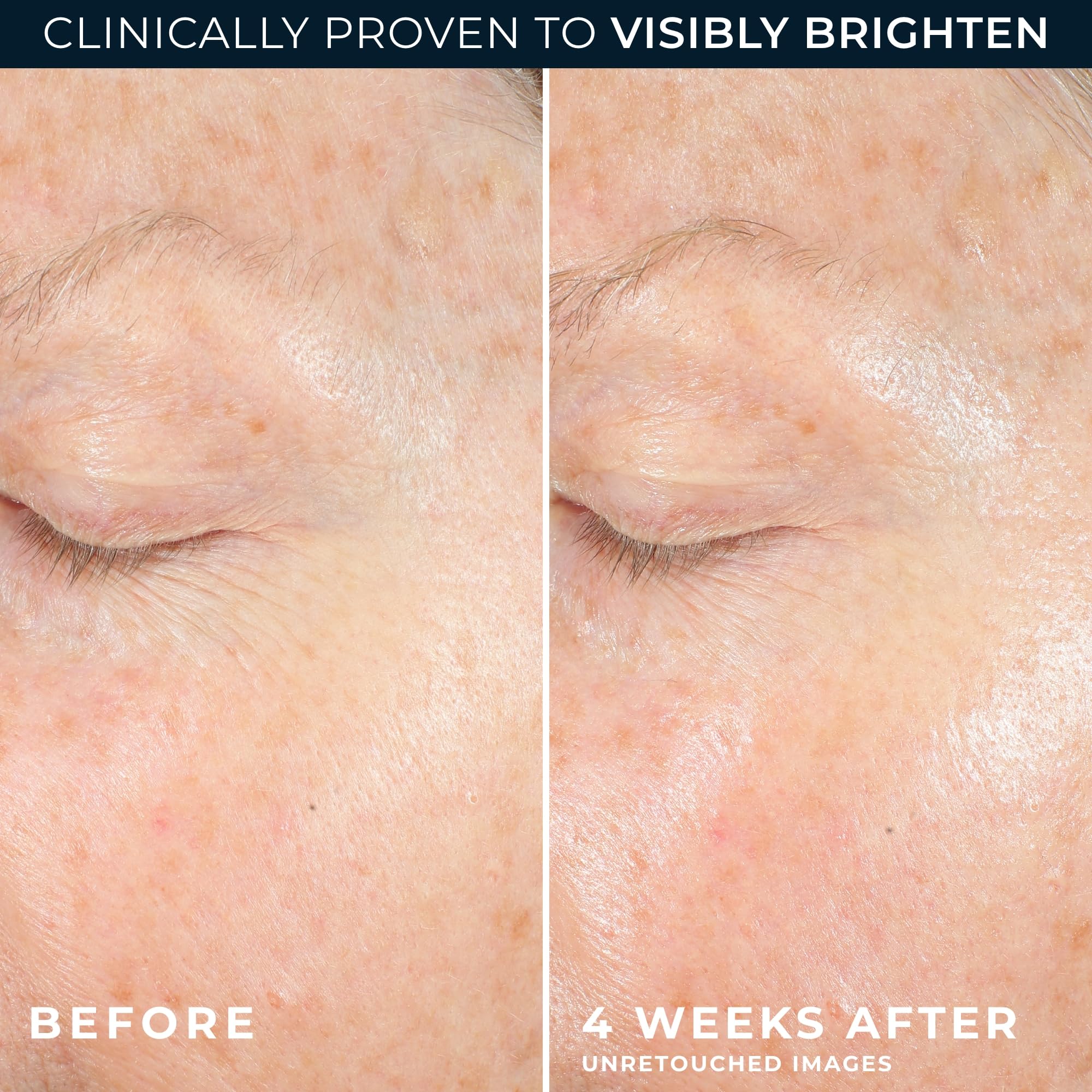 RoC Multi Correxion Revive Glow 10 Vitamin C Face - RoC Official Imagery - 6