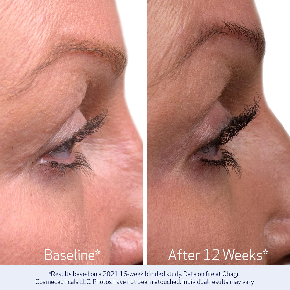 Obagi Nu Cil Eyelash Enhancing Serum - Premium Selection Official Imagery - 7