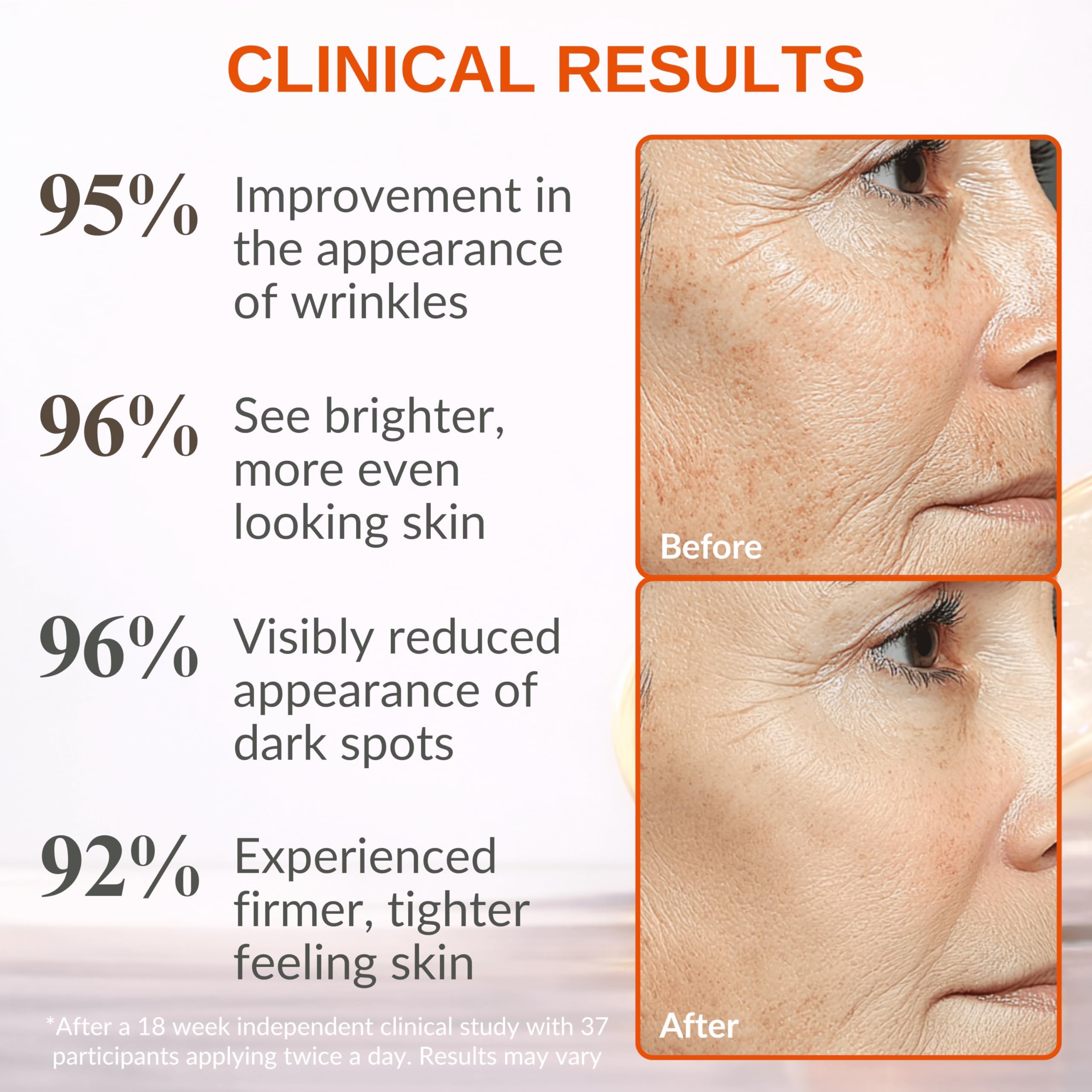 LeVaye' LeVaye Vitamin C Serum, Anti - Aging Face Serum – 15% Vitamin C & Fer - LeVaye' Official Product View 5