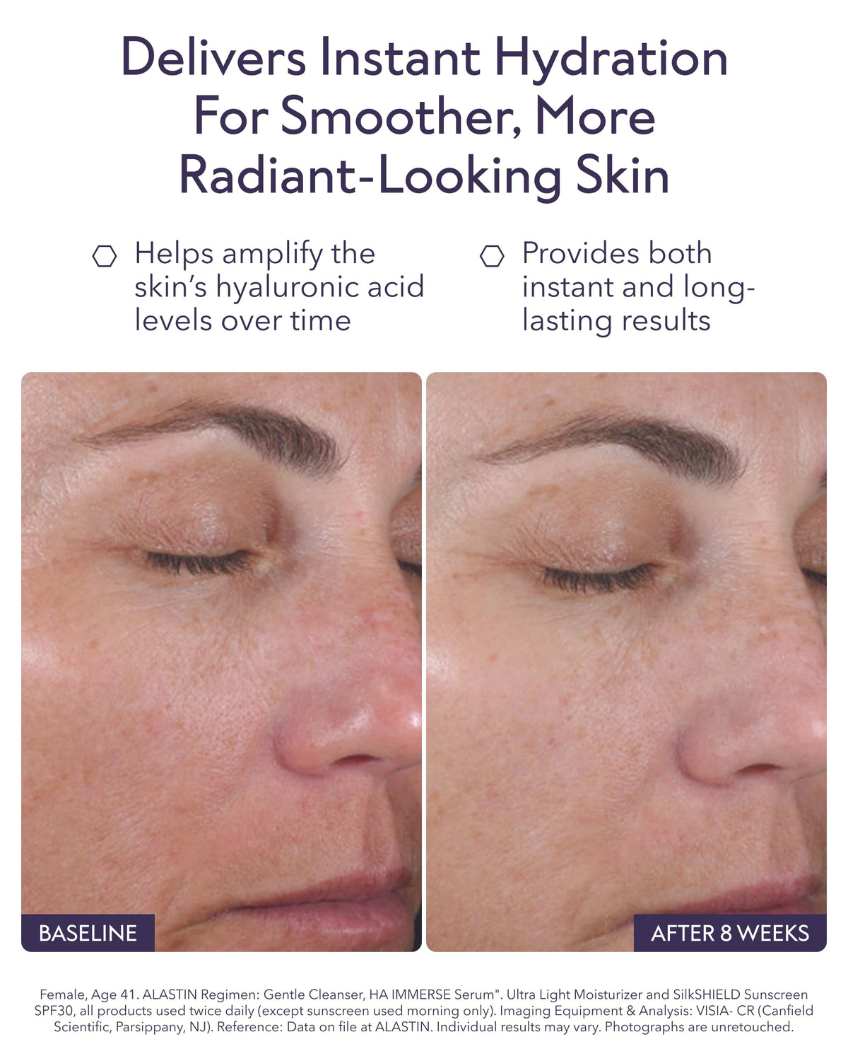 ALASTIN Skincare HA IMMERSE Hyaluronic Acid Moisturizing - Premium Selection Official Imagery - 4