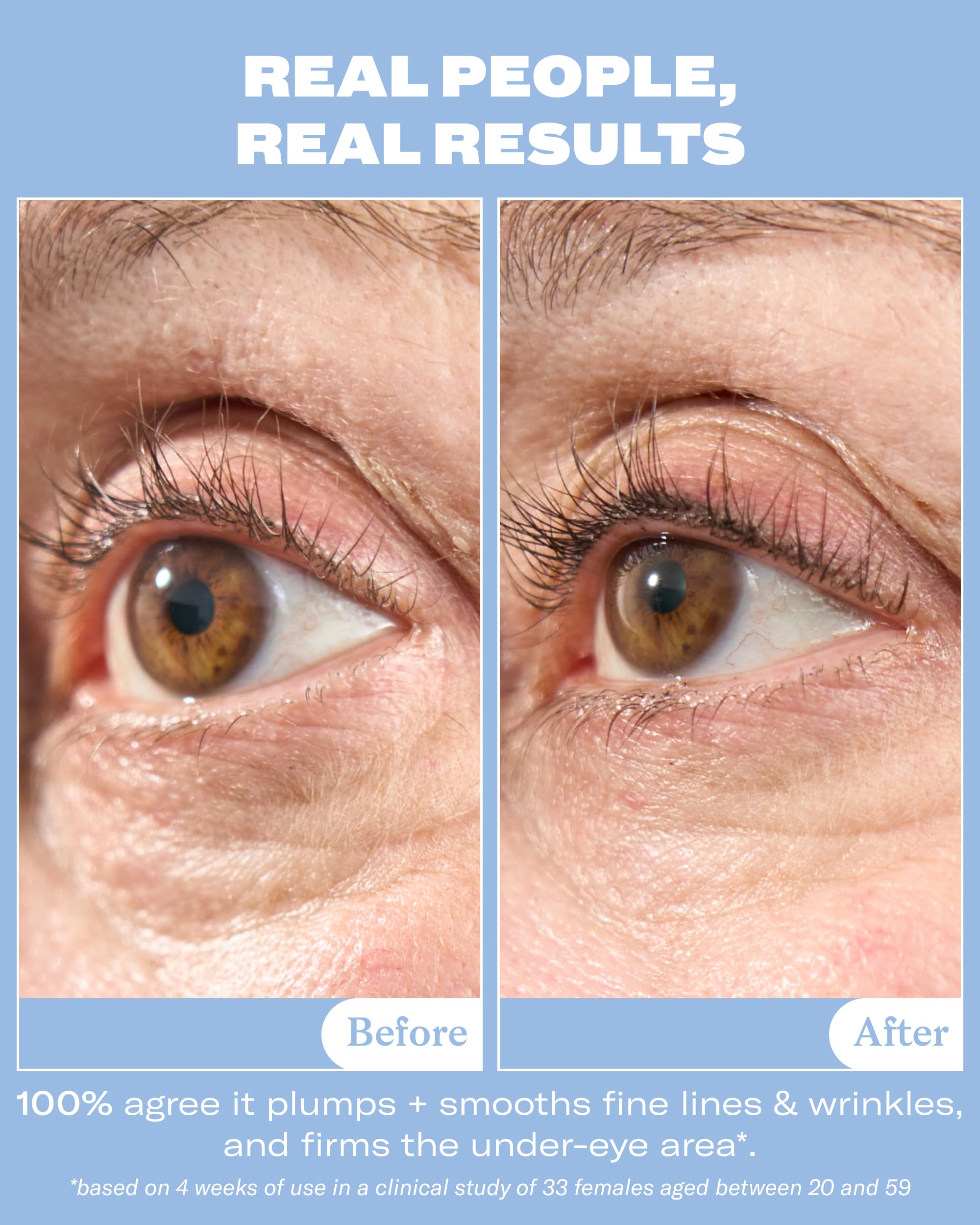 Then I Met You Snail Mucin Eye Cream, With Volufiline - Then I Met You Official Product View 3