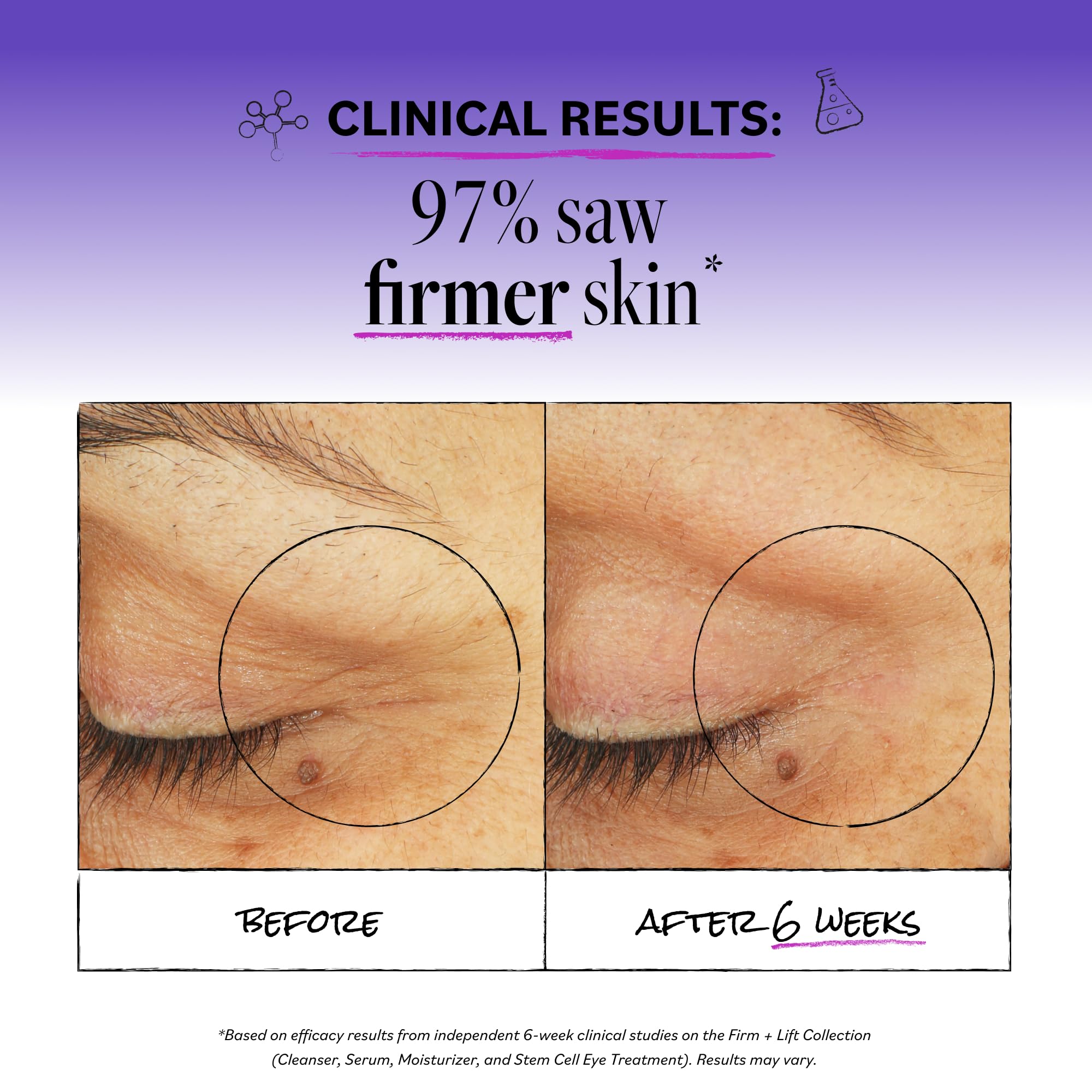 Derma E Stem Cell Lifting Eye Cream Firming Tightening 0 5 - Derma E Official Imagery - 4