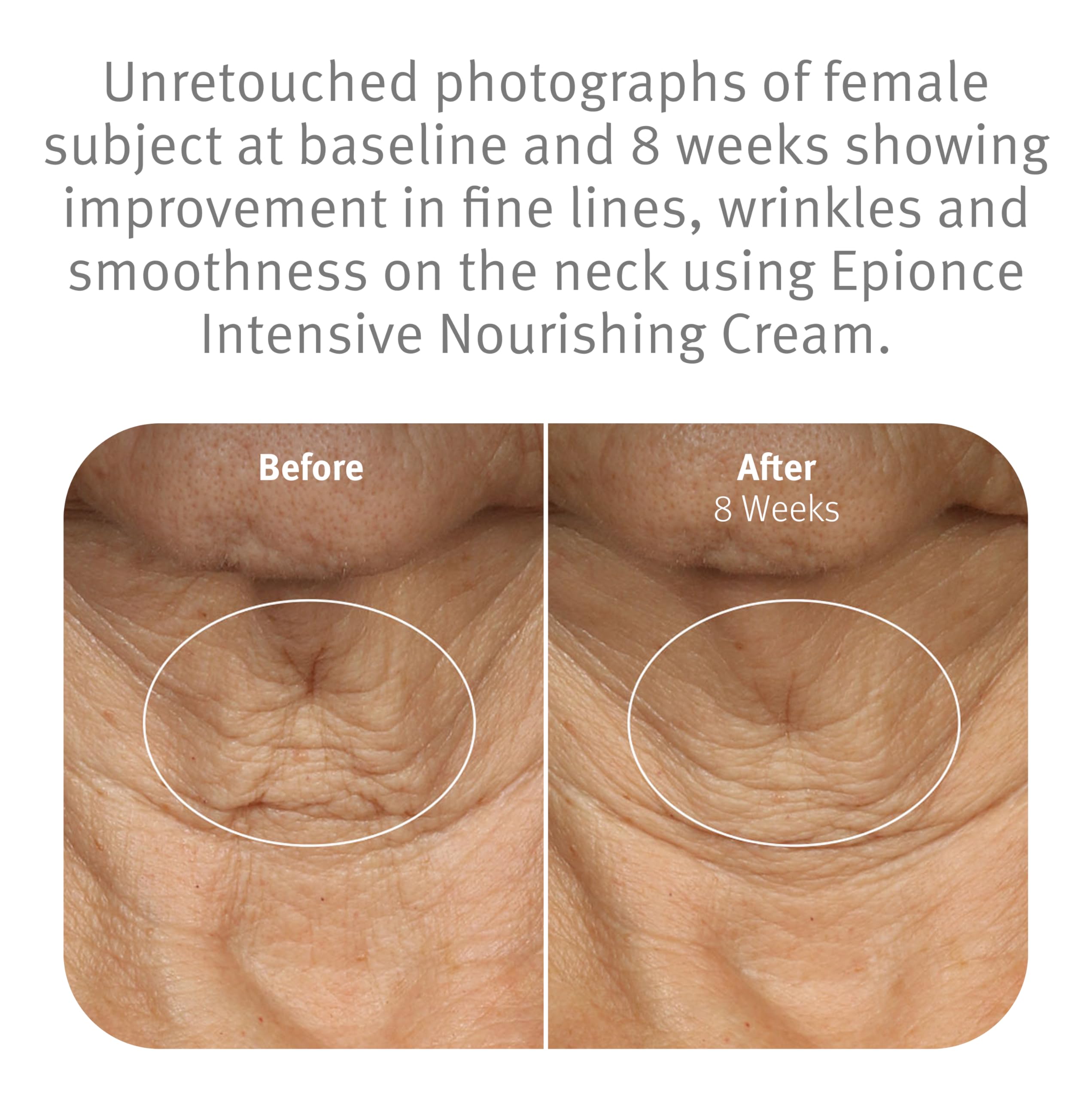 Elefair Tech Epionce Intensive Nourishing Cream Anti - Aging Face Neck Wrinkle - Elefair Tech Official Product View 5