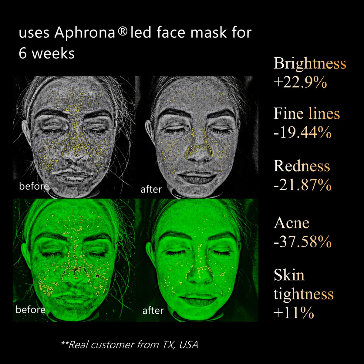 Aphrona Halo Led Face Mask Led Light Therapy for face Facial - Aphrona Official Imagery - 4