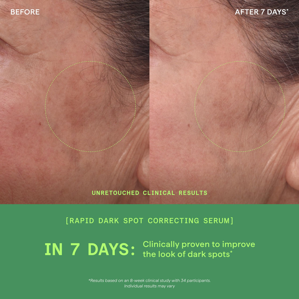 Murad Rapid Dark Spot Correcting Serum - Premium Selection Official Imagery - 5