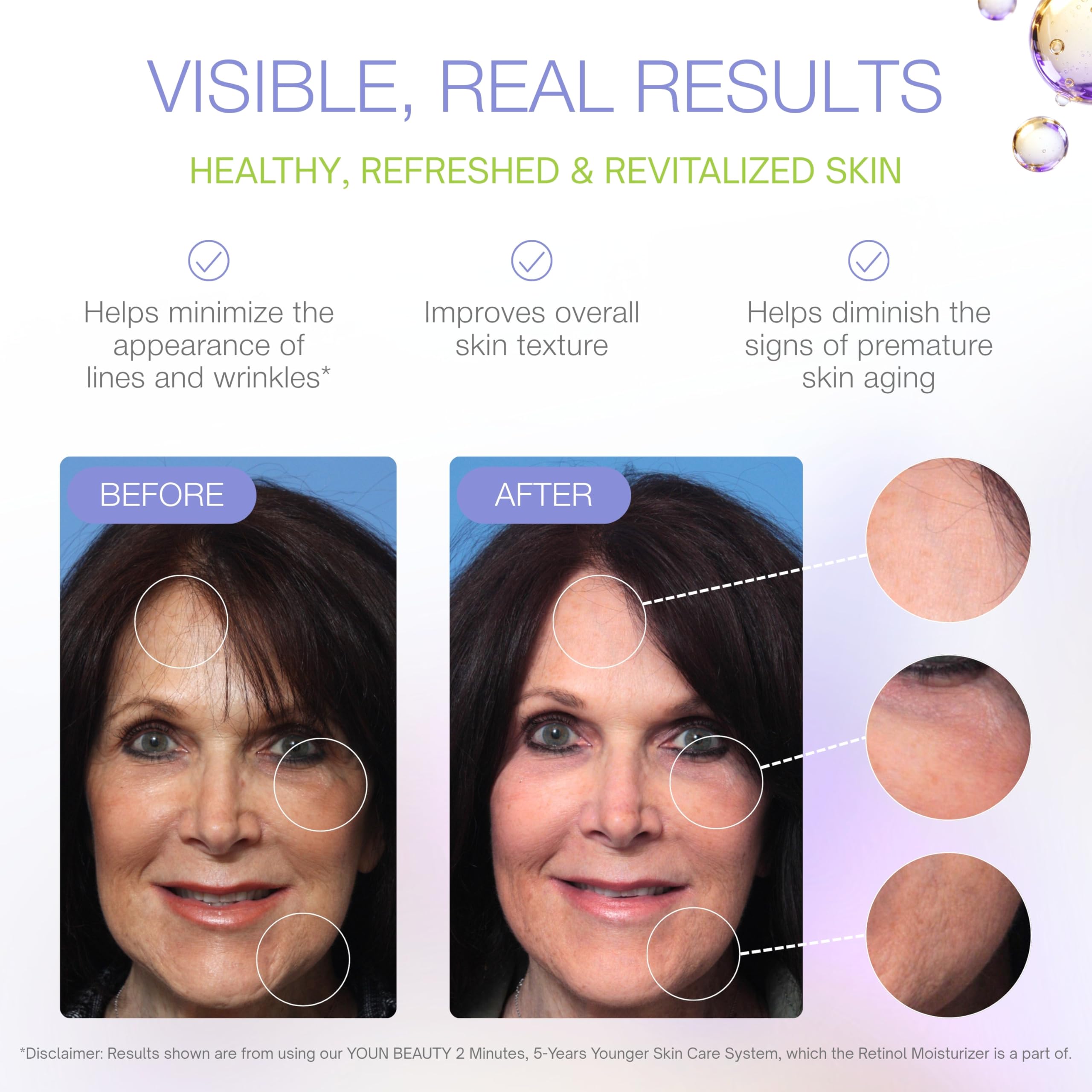 YOUN Beauty Retinol Night Cream Moisturizer for Face by - YOUN Beauty Official Imagery - 7