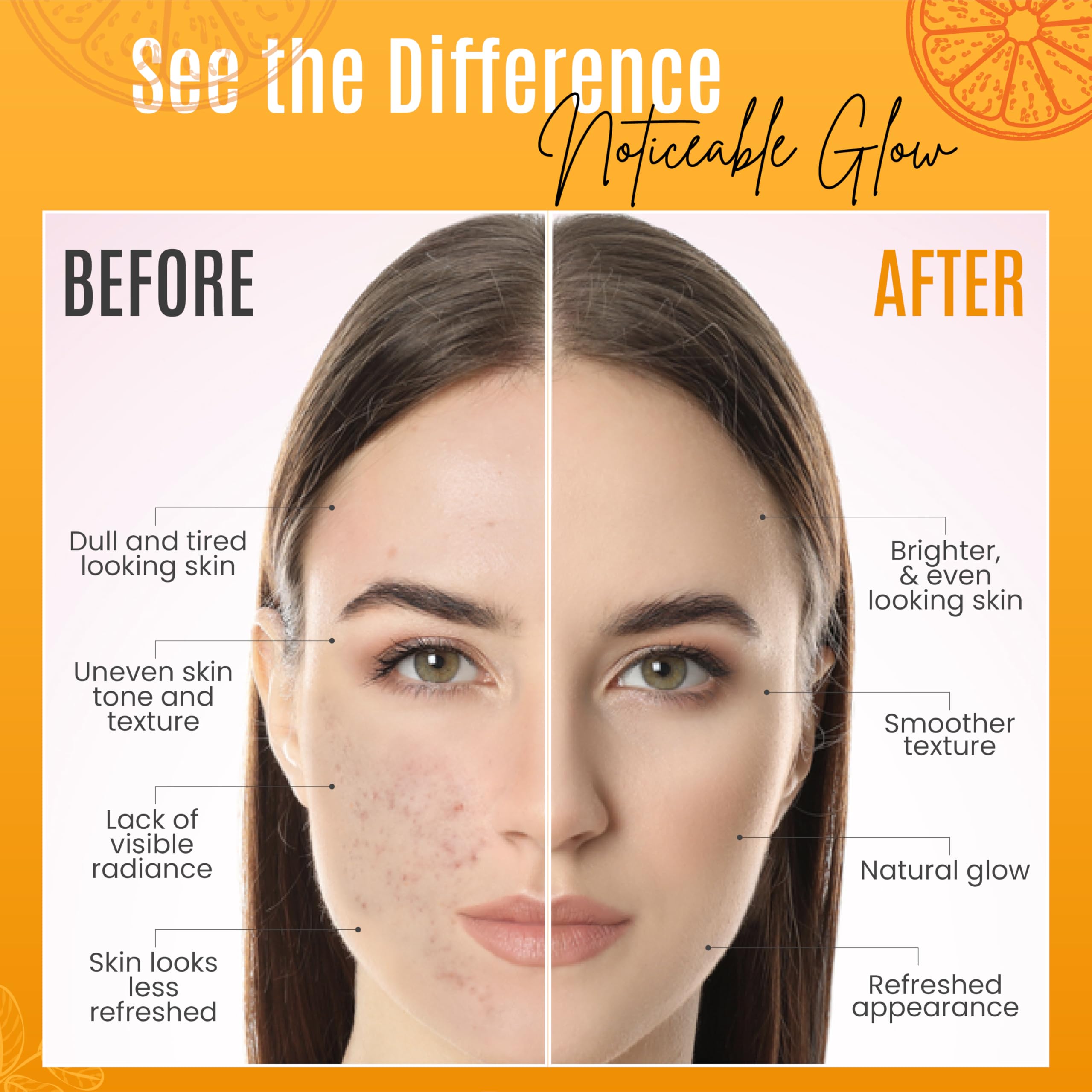 DERMAXGEN 30% Vitamin C Serum for Face - Natural & Organic Anti Wrinkle & Skin - DERMAXGEN Official Product View 8