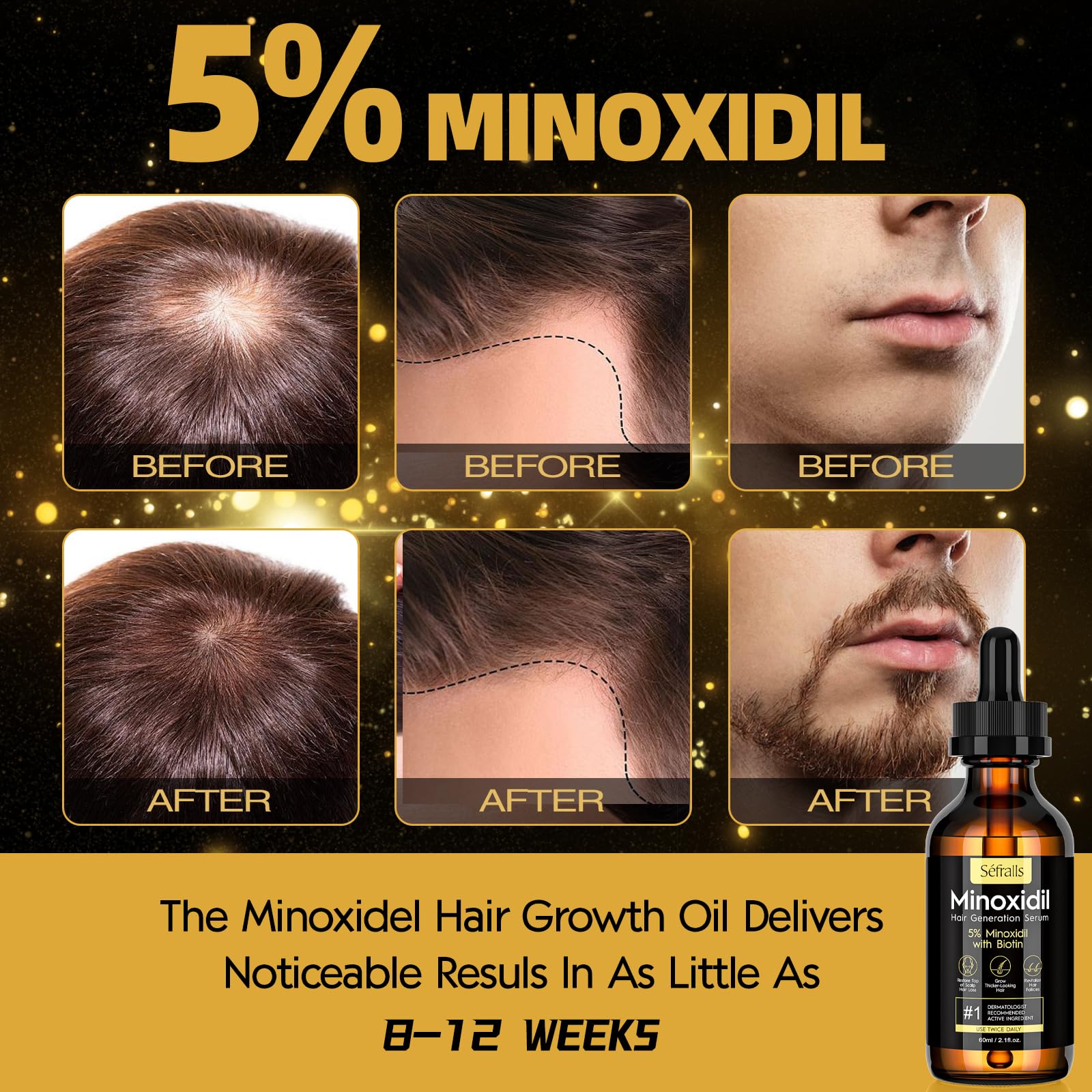 Sefralls 5% Minoxidil Hair Growth Oil - Extra Strength Growth Serum & Topical - Sefralls Official Product View 3