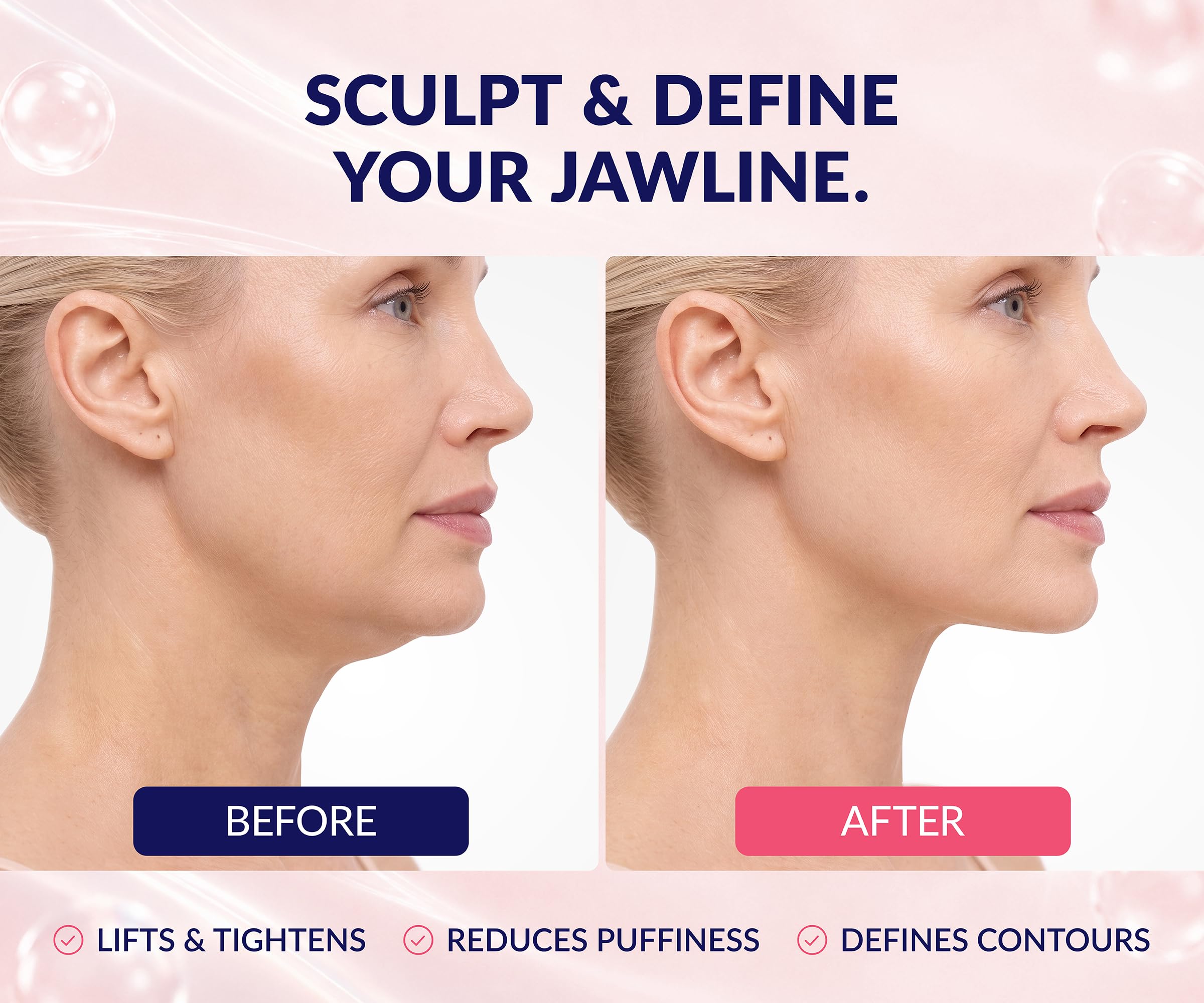 Stylia V Line Lifting Collagen Mask - Lift, Firm & Contour Jawline - T - View 3