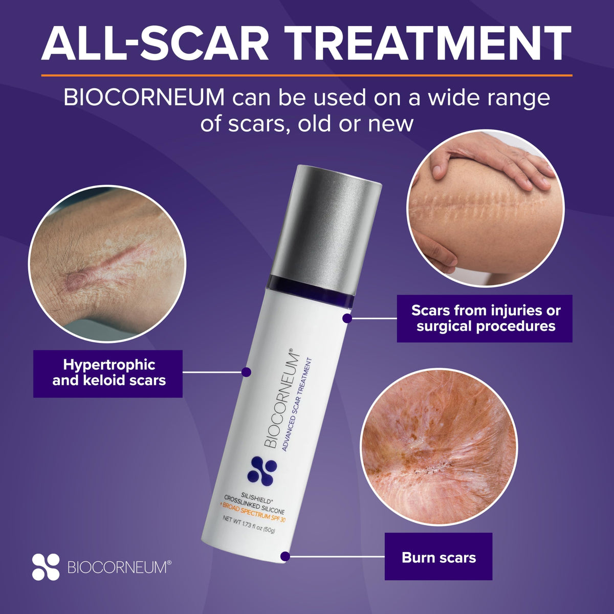 Biocorneum Silicone Scar Gel with Silishield SPF 30 Scar - BIOCORNEUM Official Imagery - 6
