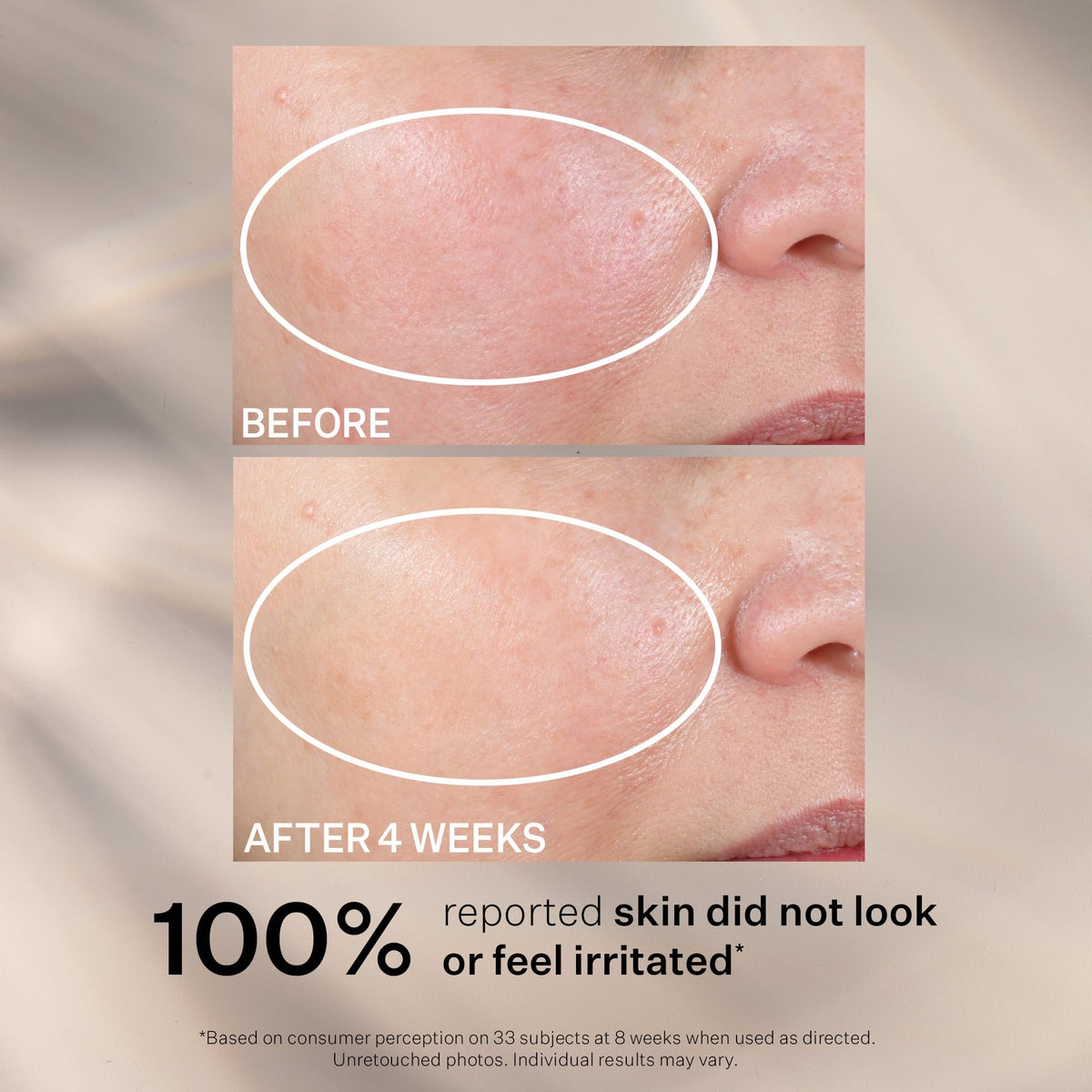 StriVectin Advanced Retinol Targets Visible Signs of Aging - Premium Selection Official Imagery - 7