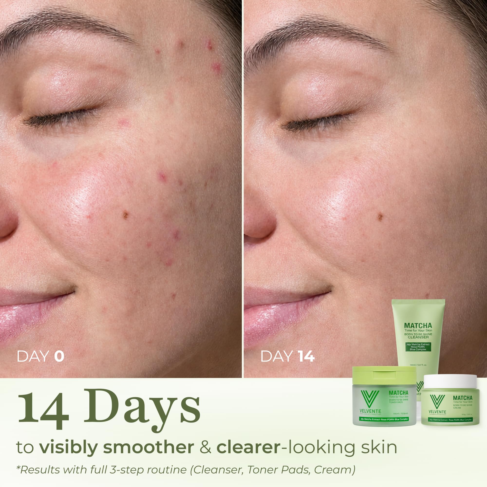 Matcha PDRN Korean Cleanser & Face Wash, Acne-Prone Sensitive... - VELVENTE Official Product View 8