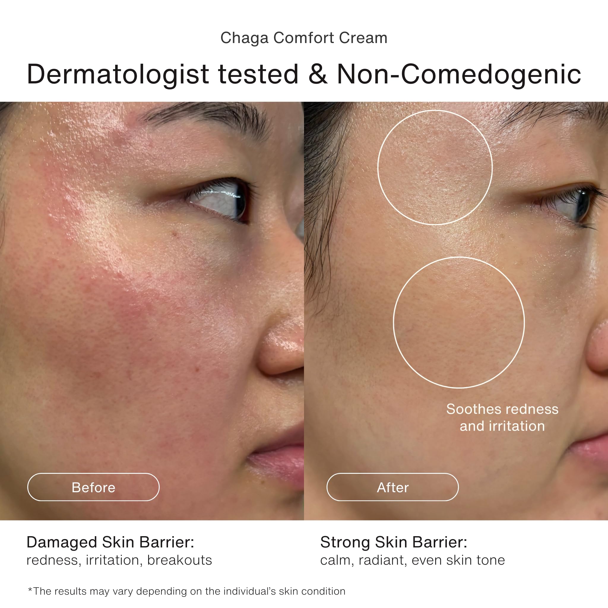Korean Skincare Set - AROOM