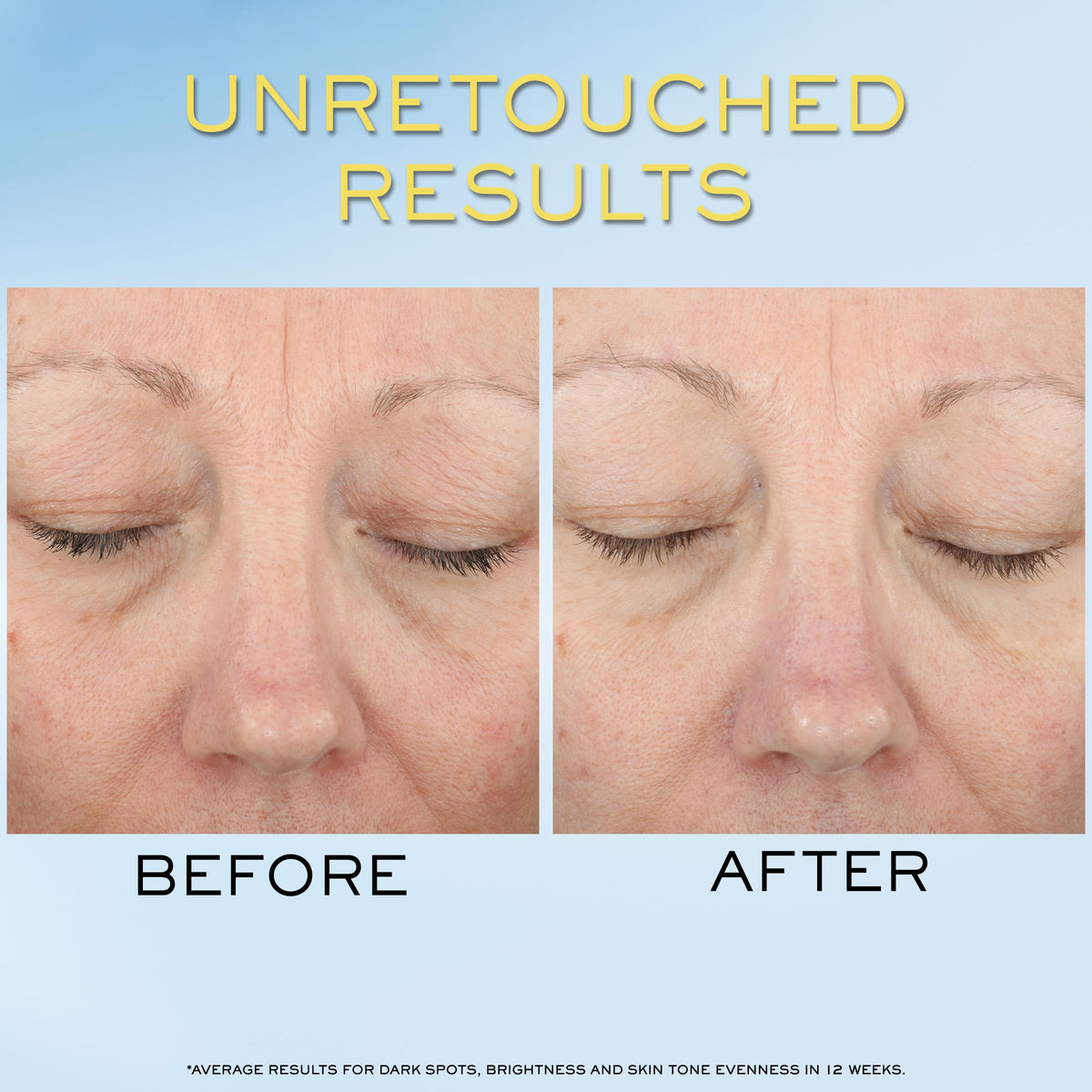 Lanc me Supra Screen Invisible Serum Sunscreen SPF 50 - Premium Selection Official Imagery - 5