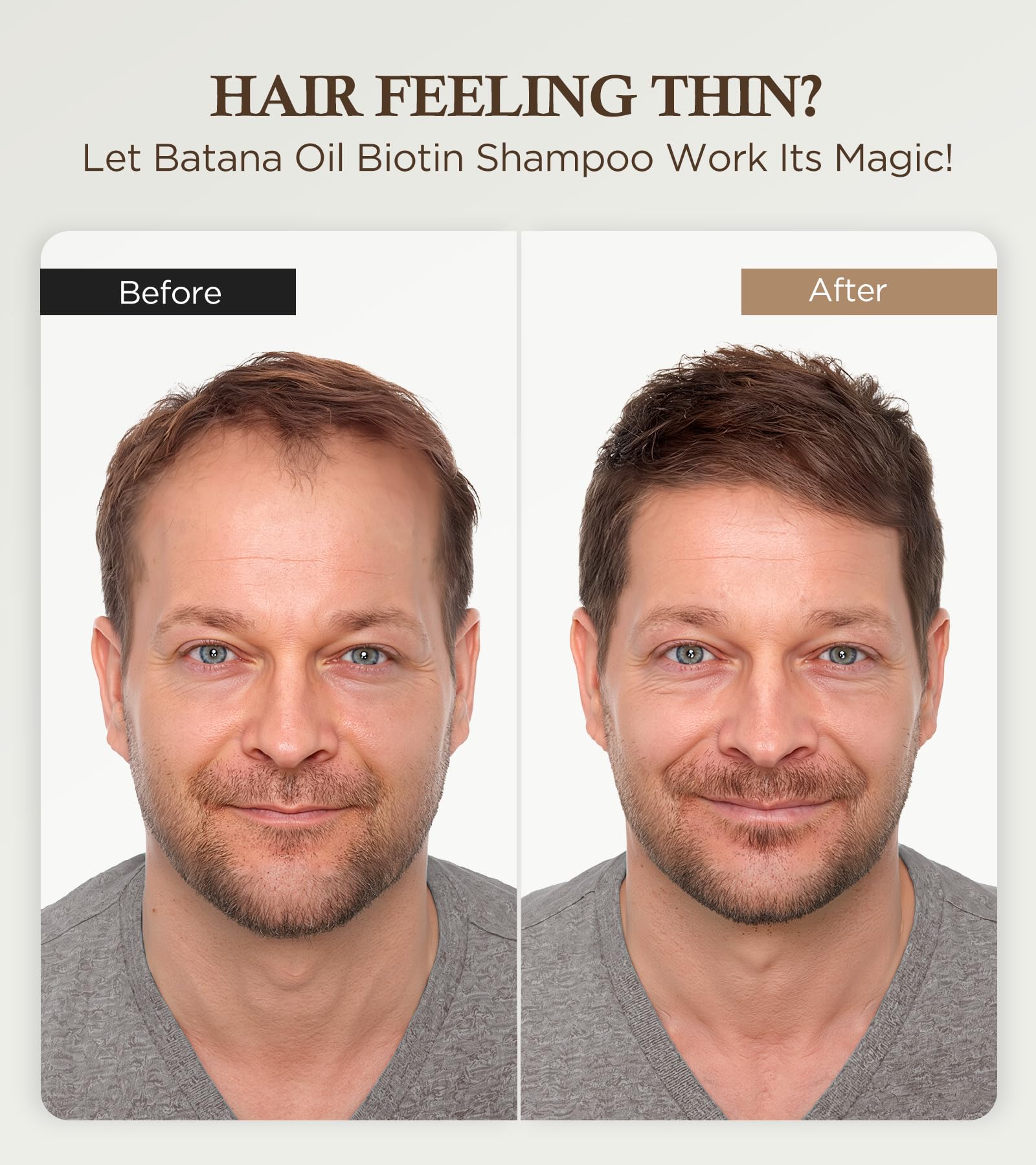 GOWILOVE Biotin Shampoo for 3X Faster Hair Growth, 80% Less Hair Loss w - Thuja - GOWILOVE Official Product View 3